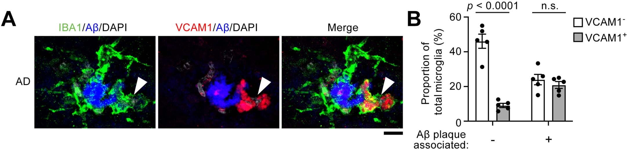 Extended Data Fig. 5: VCAM1+ microglia interact with amyloid-beta plaques in the brains of patients with Alzheimer’s disease.