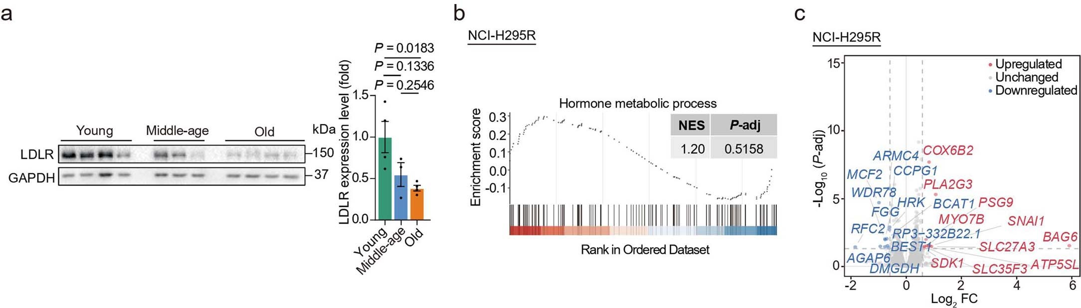 Extended Data Fig. 6: Reduced LDLR hinders DHEA-S secretion in adrenocortical cells.