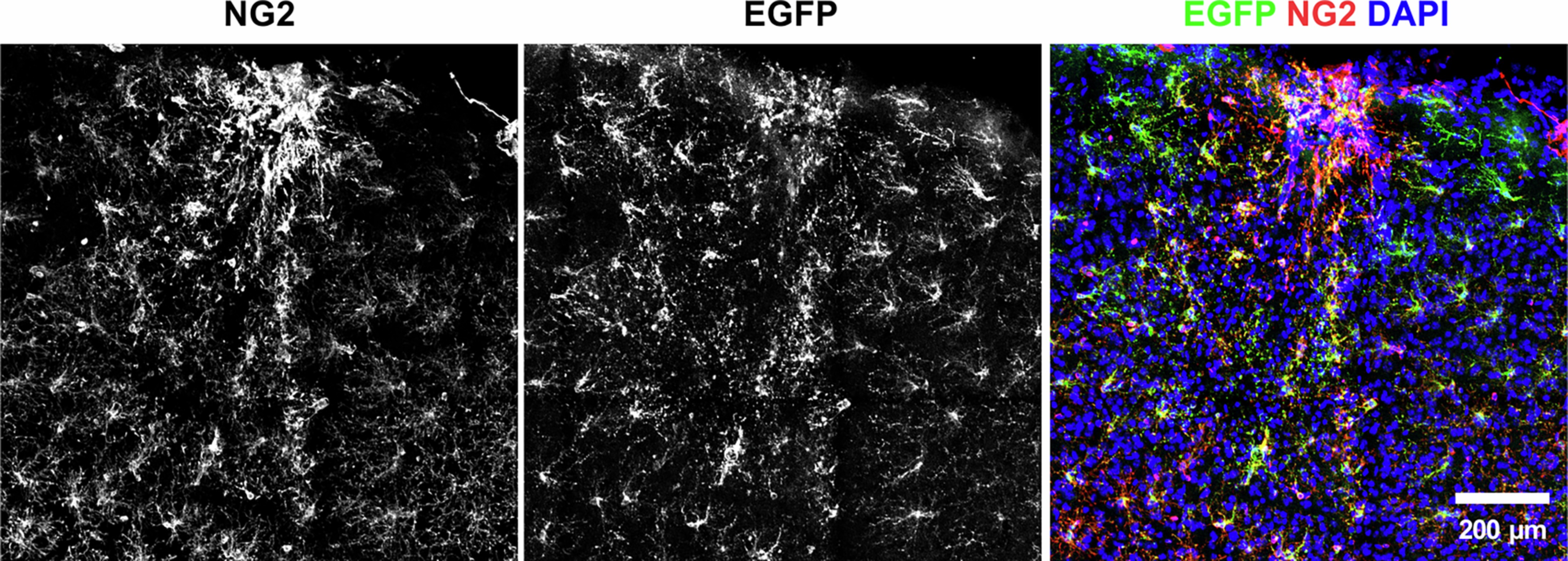 Extended Data Fig. 8: Matn4-mEGFP signal is restricted to OPCs even after a stab wound injury.