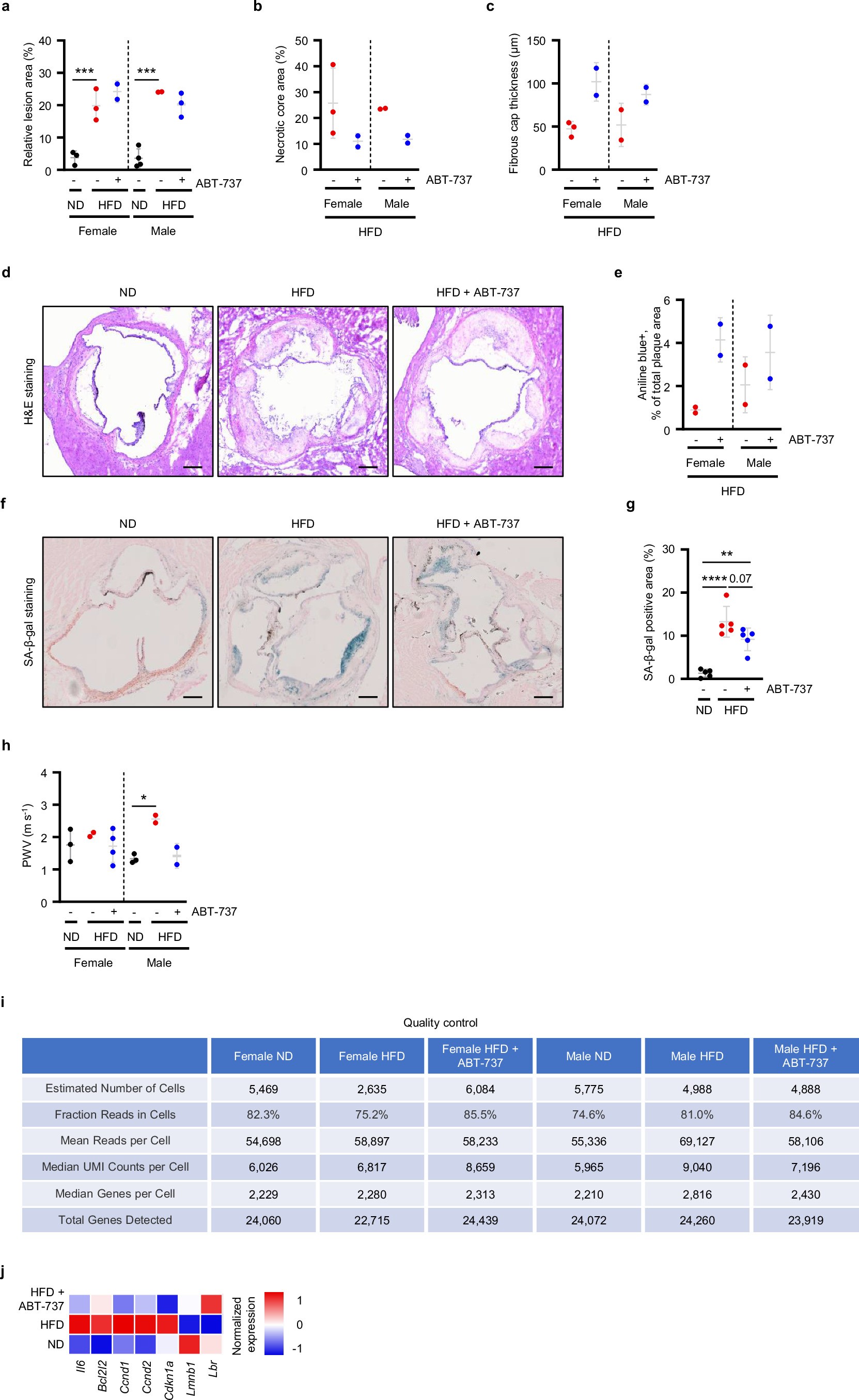 Extended Data Fig. 1: Atherosclerotic plaque pathology analysis and quality control analysis.