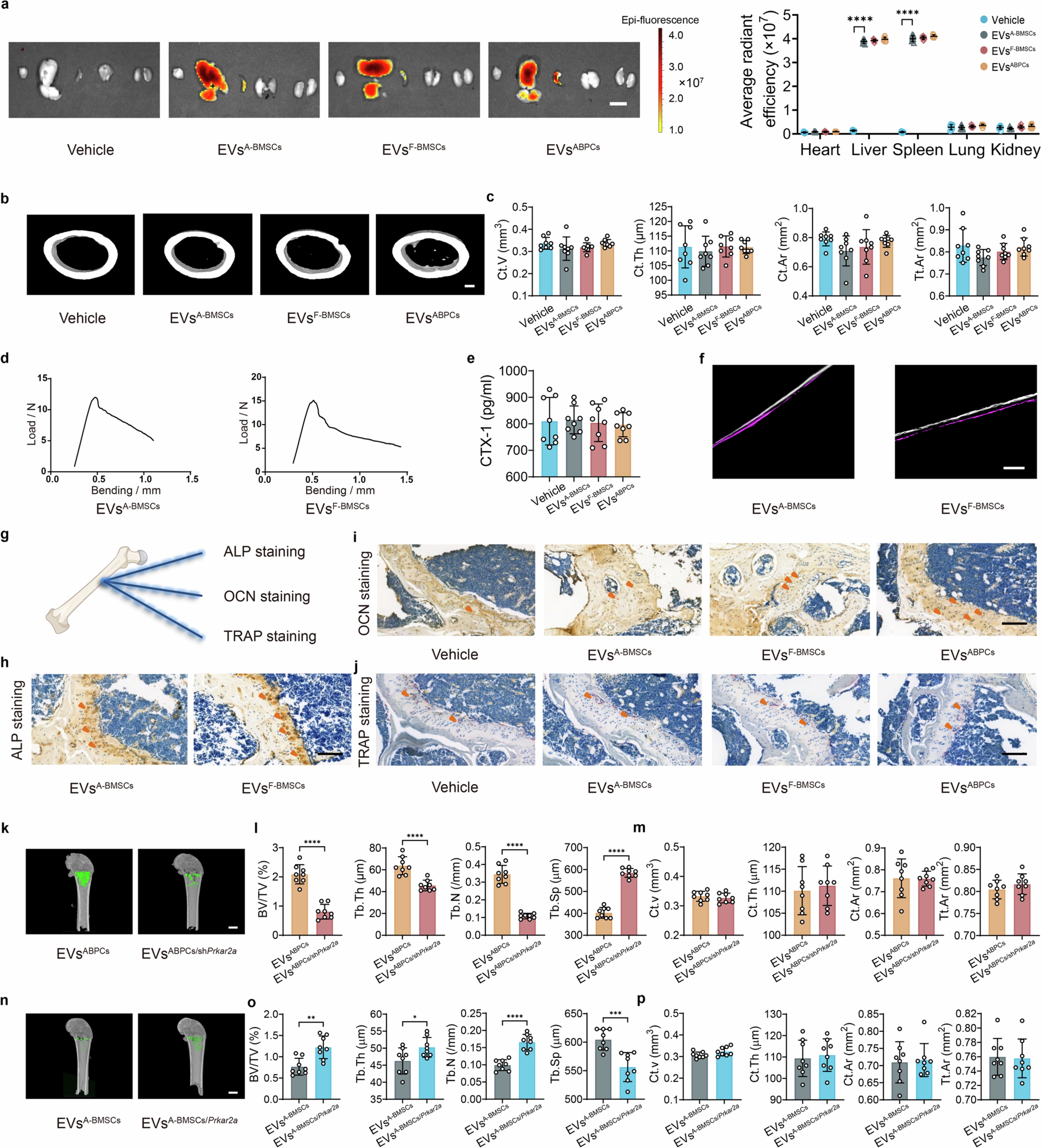 Extended Data Fig. 5: EVsABPCs mitigate age-related bone loss in aged mice.
