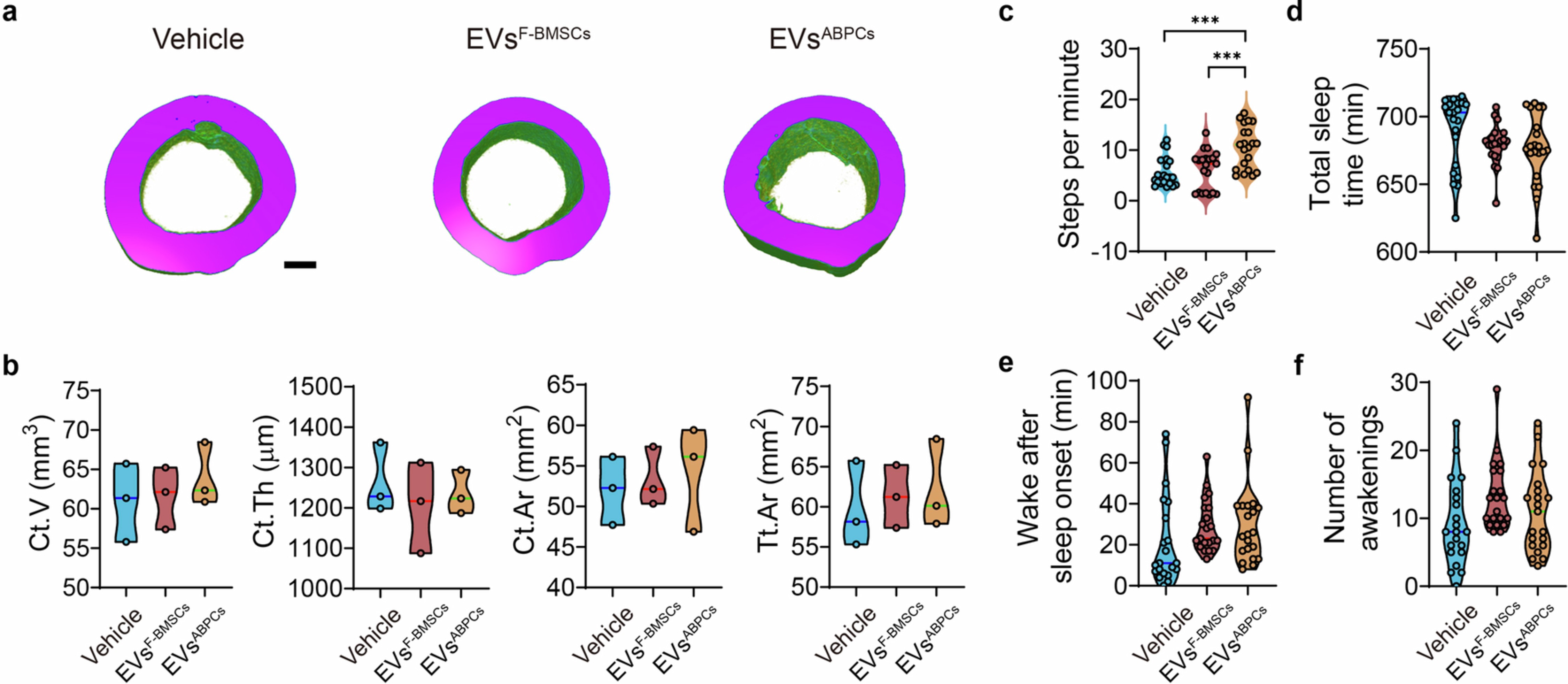 Extended Data Fig. 8: EVsABPCs ameliorate bone loss and improved locomotor functions in aged rhesus macaques.