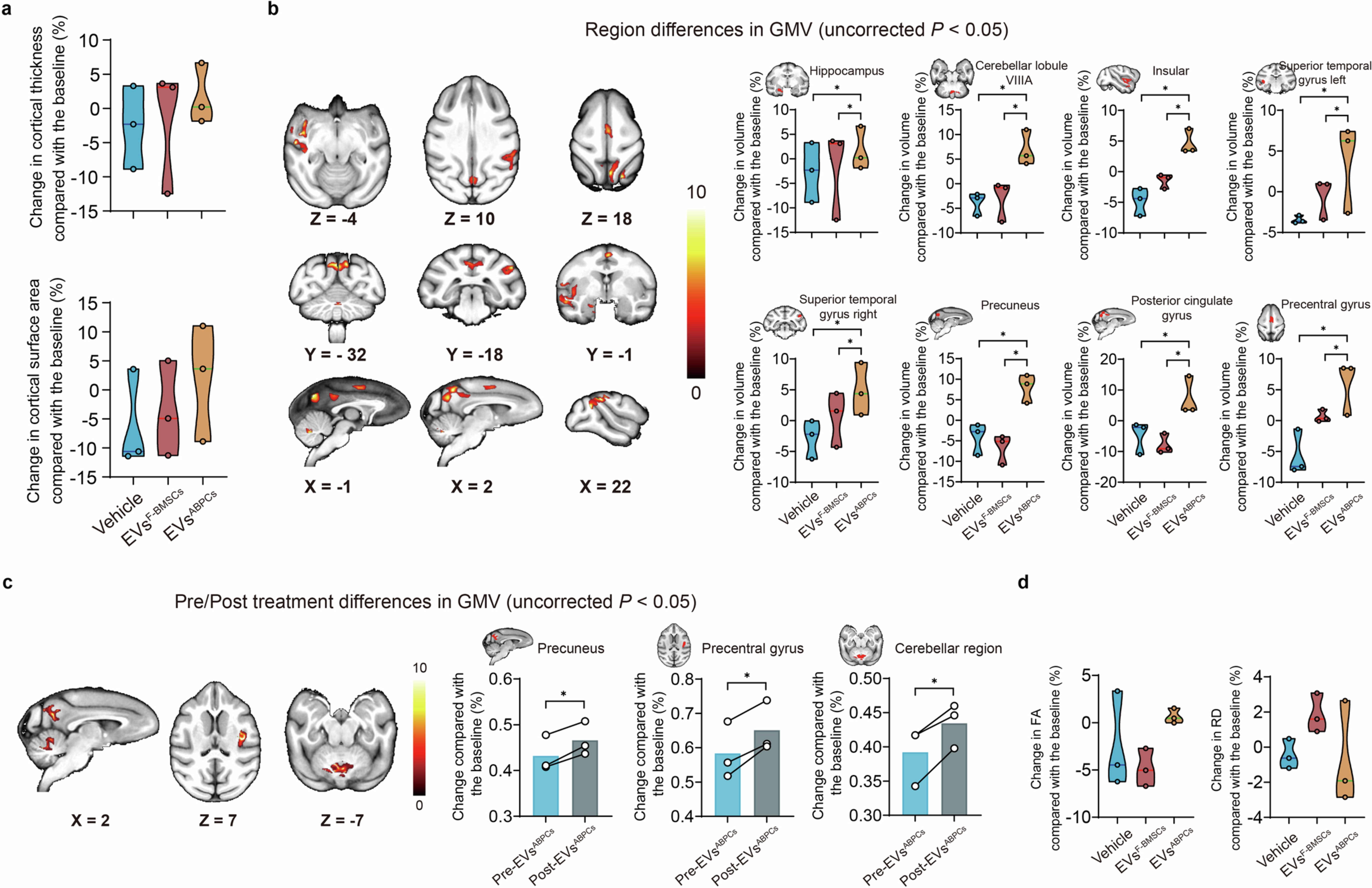 Extended Data Fig. 10: Changes related to brain aging in EVsABPCs-treated aged rhesus macaques.