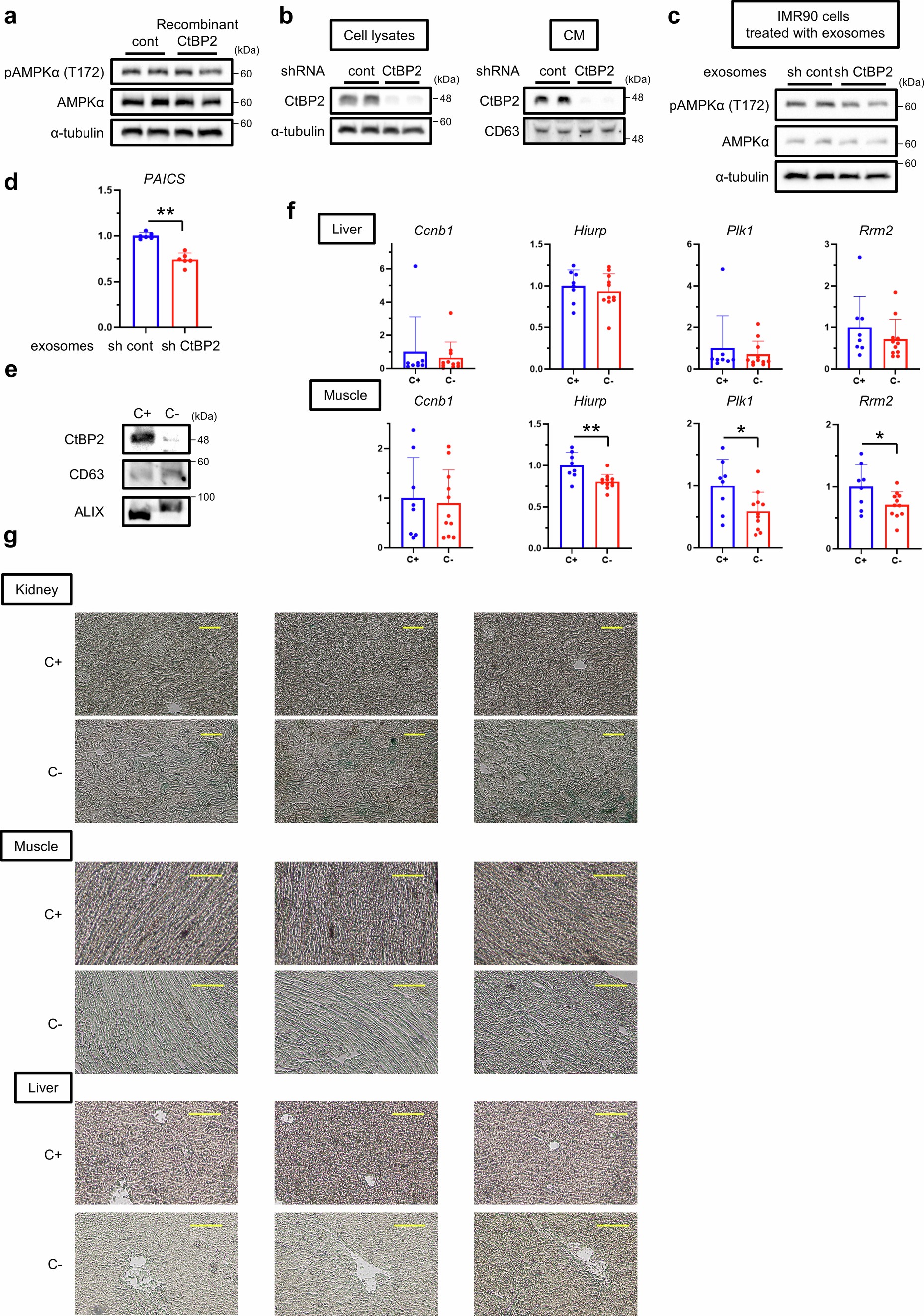 Extended Data Fig. 9: The effects of exosomal CtBP2.