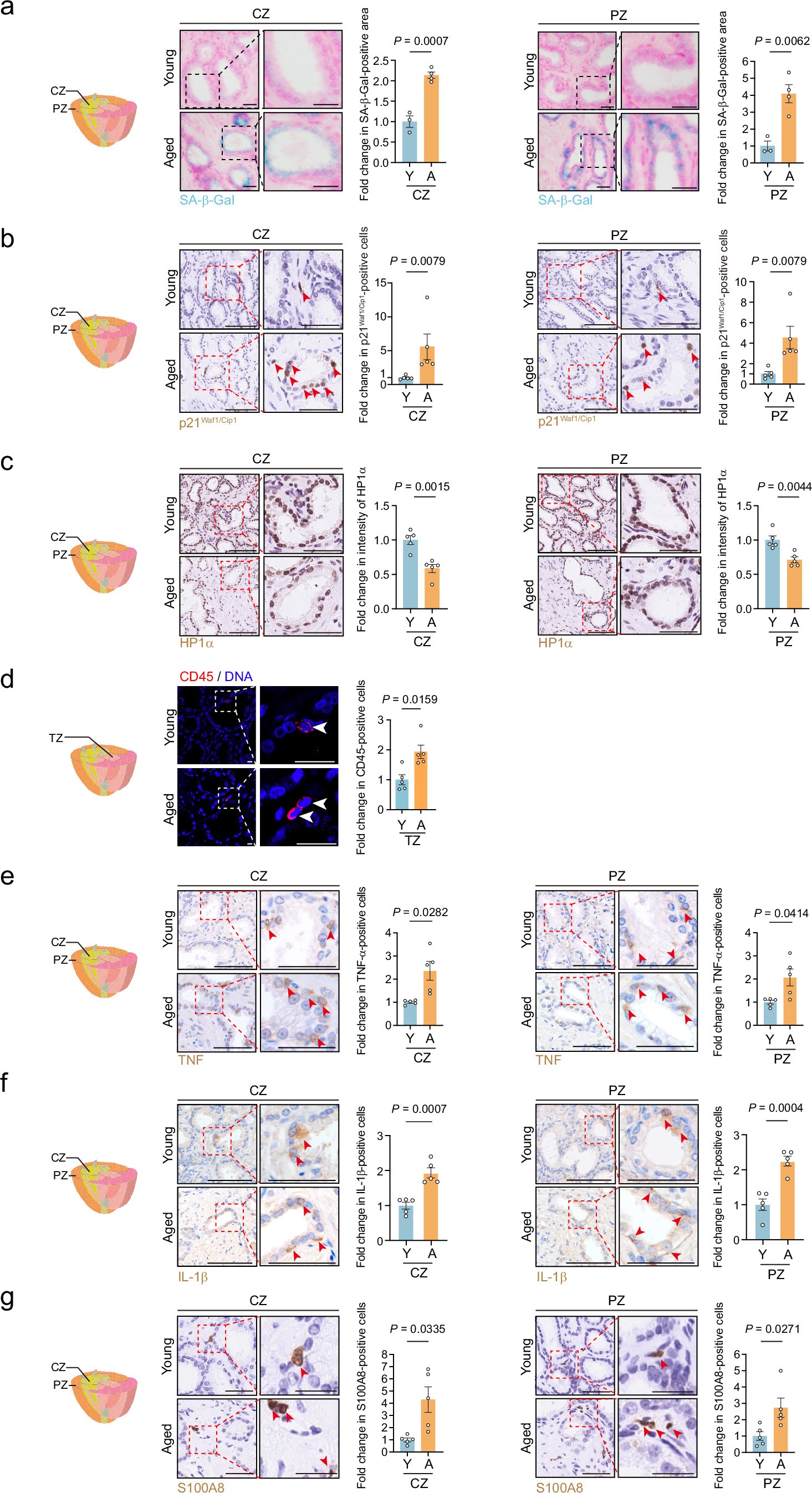 Extended Data Fig. 2: Aging-related inflammatory phenotypes of monkey prostate.