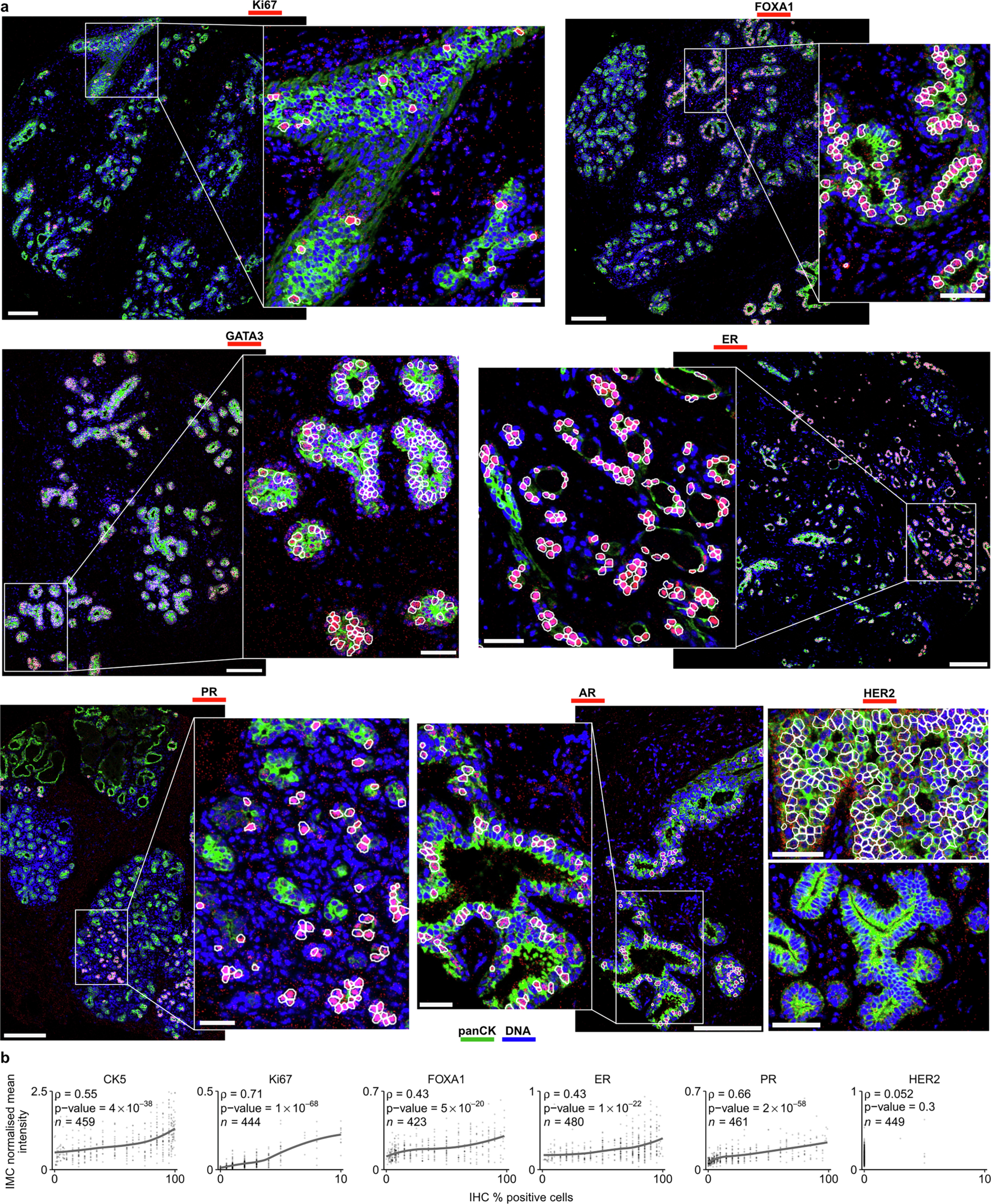 Extended Data Fig. 2: Representative threshold calls for Ki67 and luminal markers and IHC validation of IMC data.
