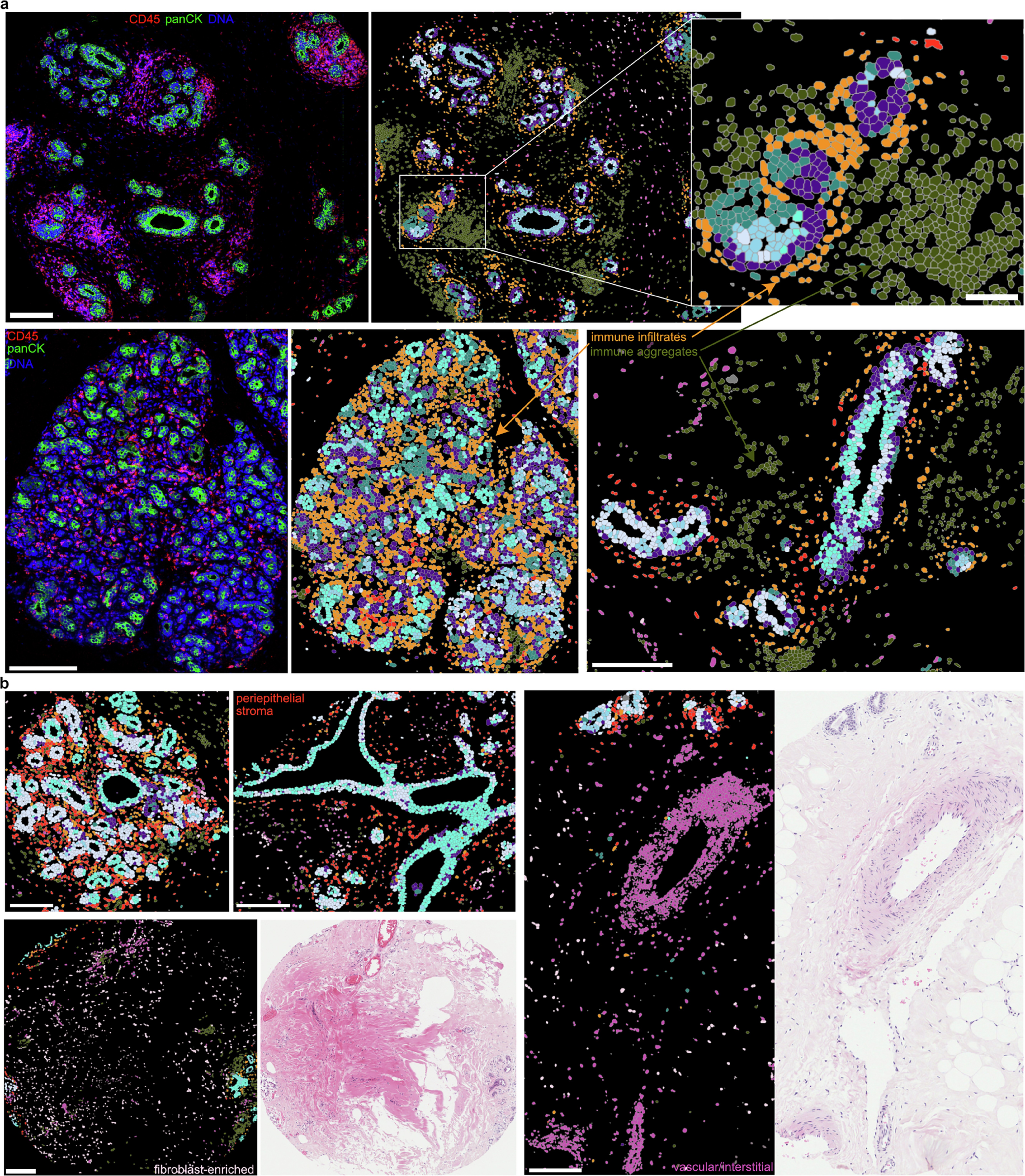 Extended Data Fig. 7: Representative immune and stromal spatial neighbourhood examples.