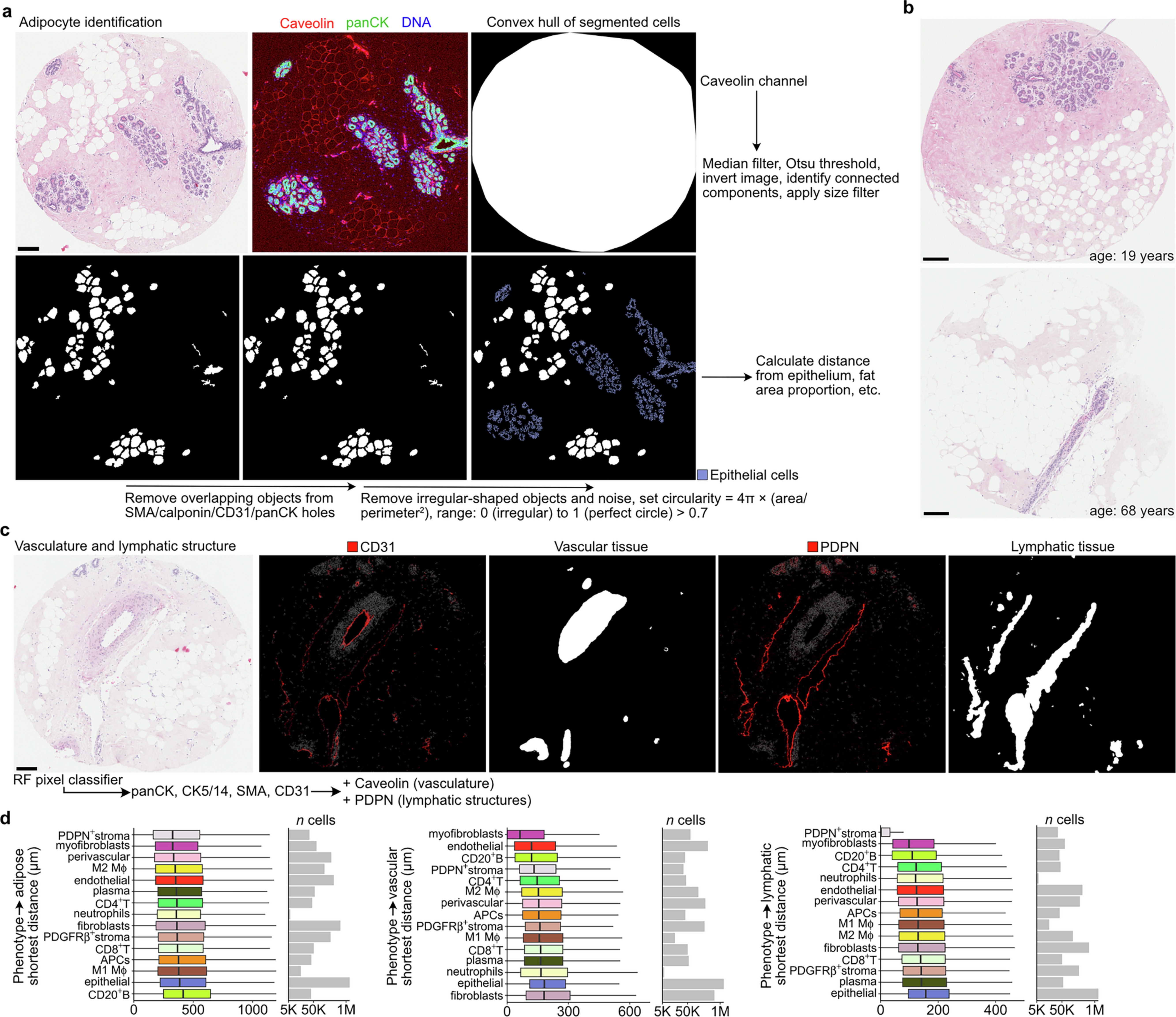 Extended Data Fig. 9: Identification of adipocytes, vasculature, and lymphatic tissue.