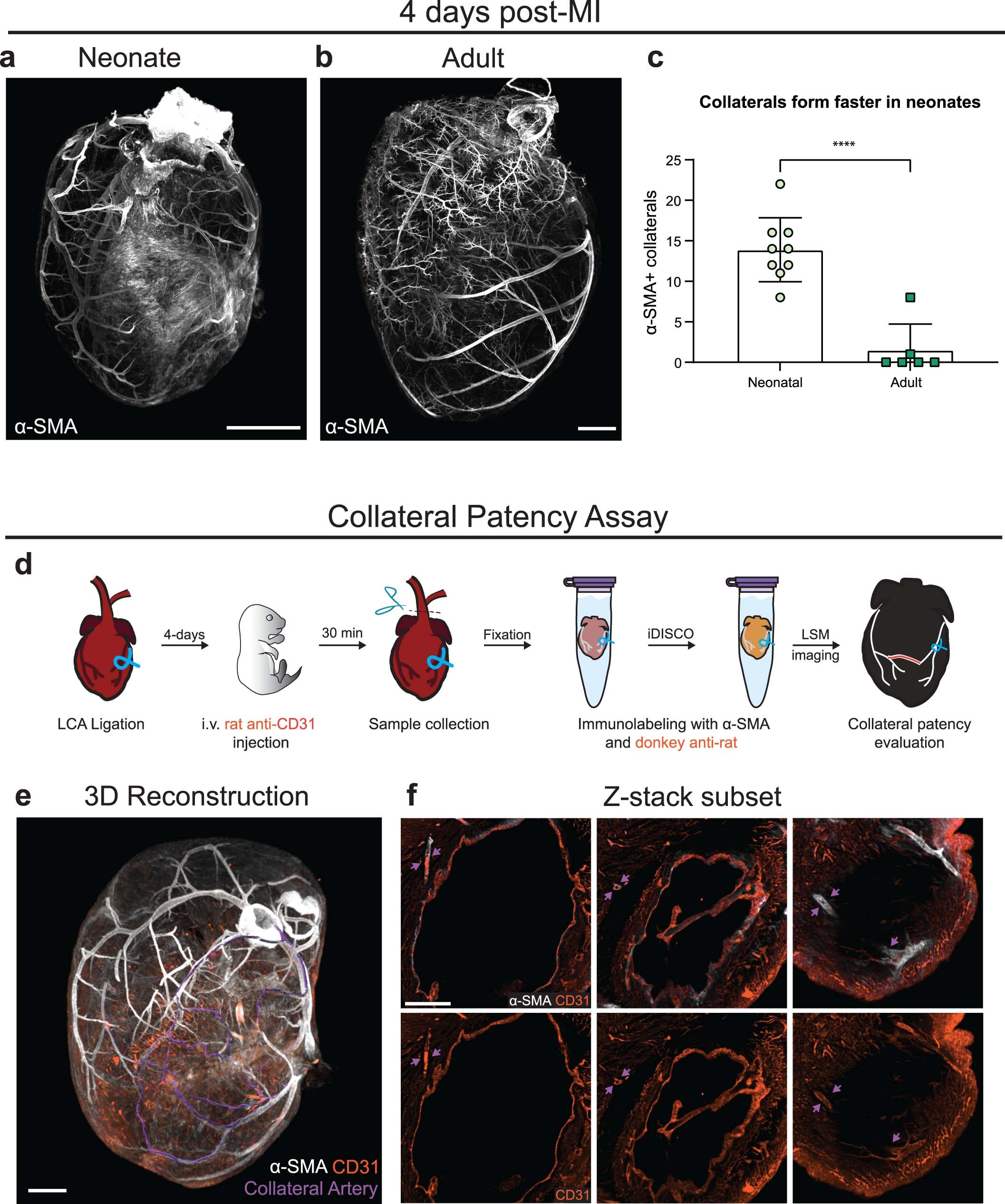 Extended Data Fig. 2: Collateral artery assessments.