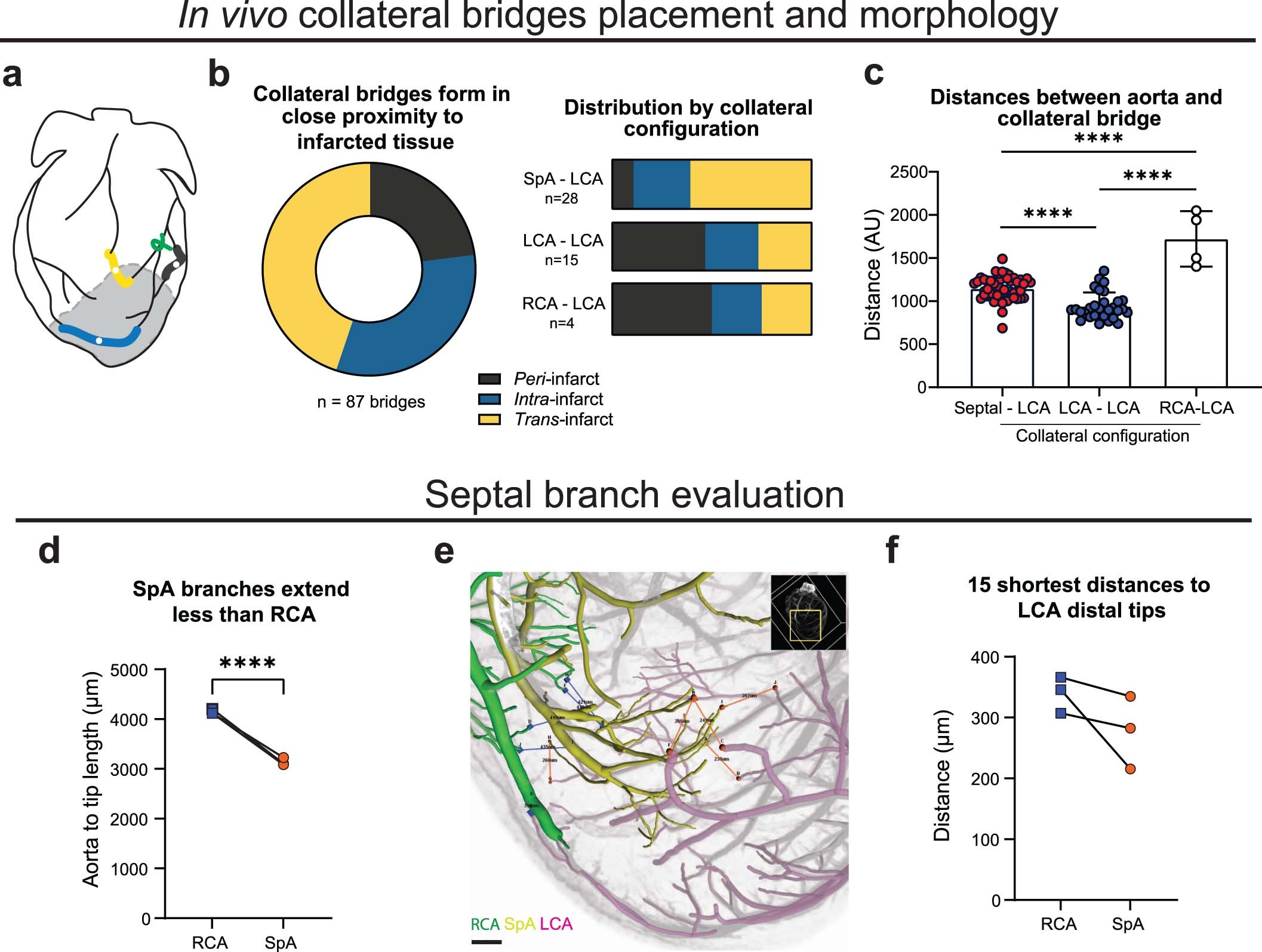 Extended Data Fig. 3: Investigation into parameters related to collateral artery placement.