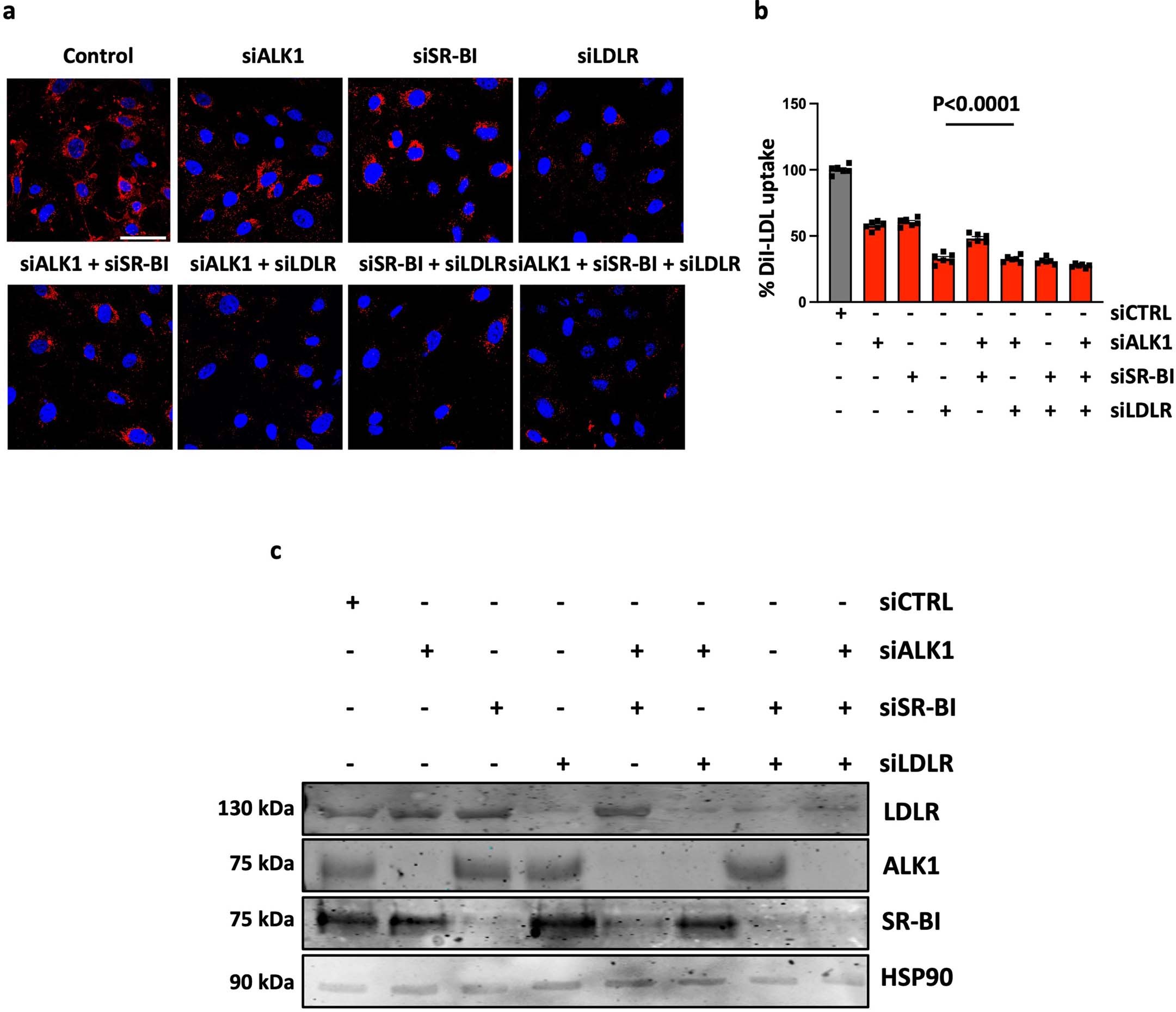 Extended Data Fig. 6: LDL uptake is regulated by ALK1, SR-BI, or LDLR.