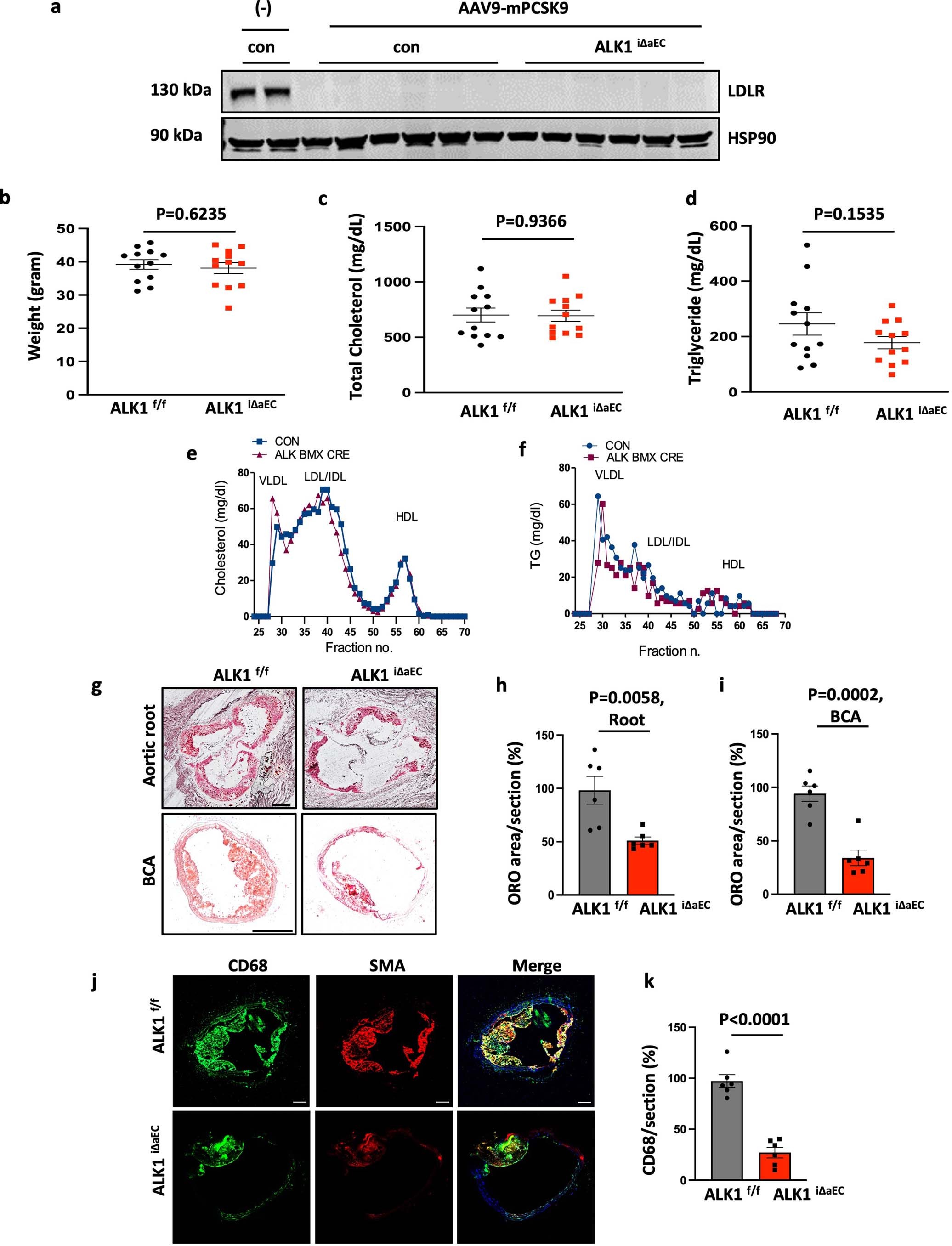 Extended Data Fig. 2: Arterial EC ALK1 deficiency reduces the atherosclerosis progression.
