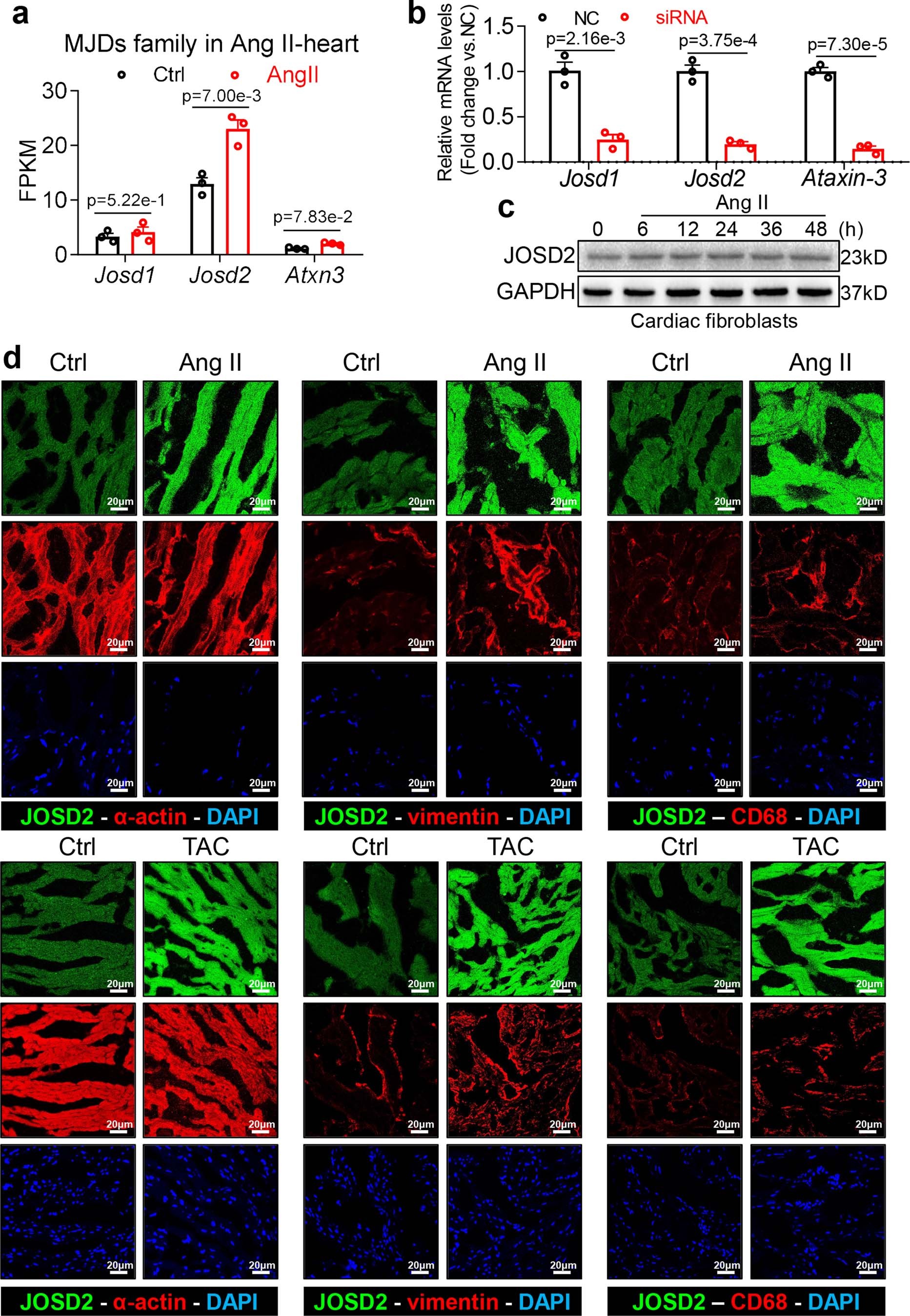 Extended Data Fig. 1: Identification of JOSD2 as a regulator in cardiac hypertrophy.