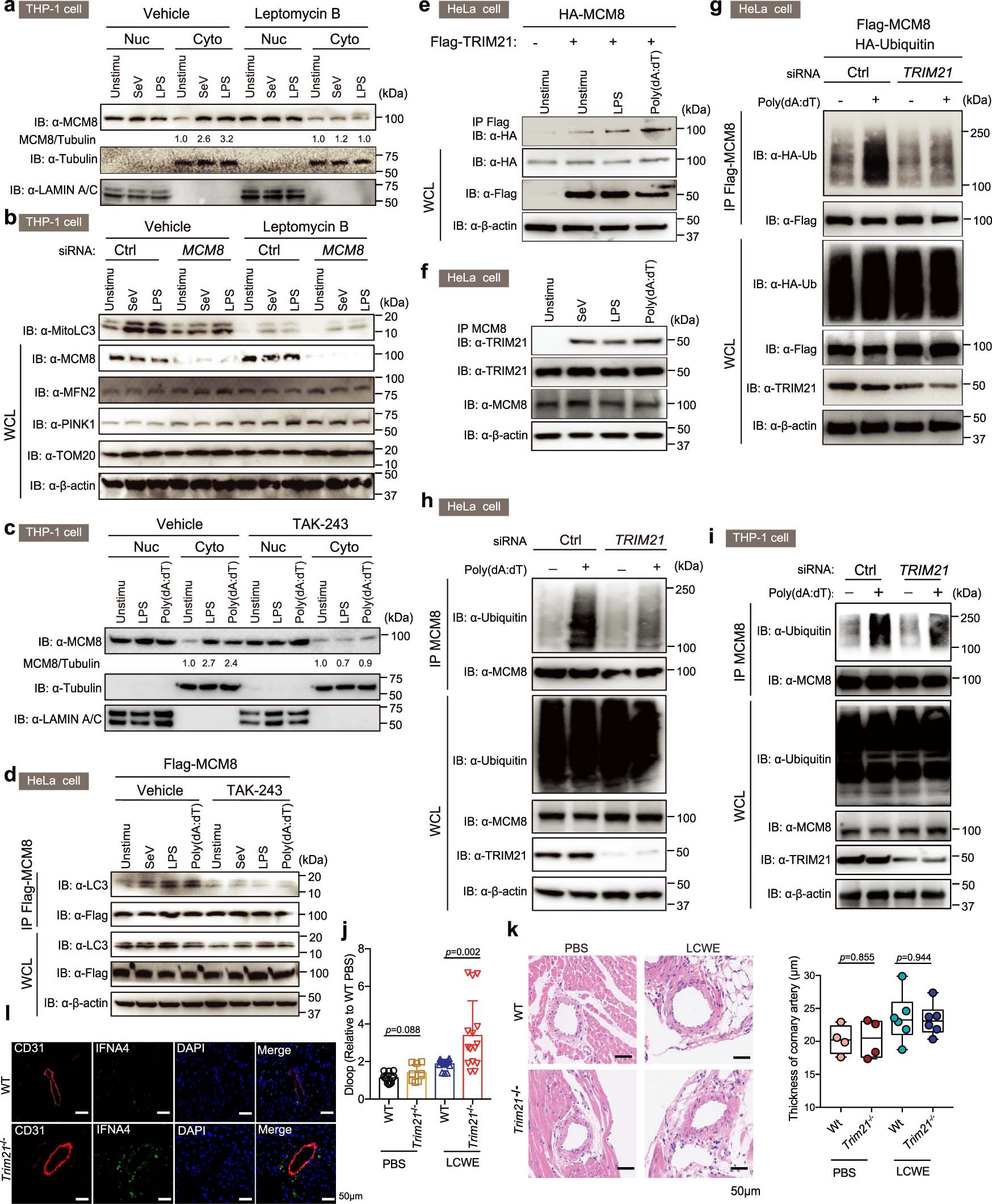 Extended Data Fig. 7: TRIM21 regulates MCM8 ubiquitination and cytosolic export.