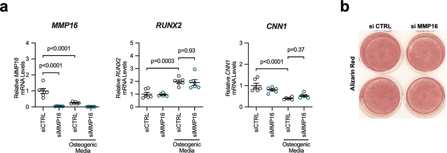 Extended Data Fig. 5: Silencing MMP16 expression has no effect on osteogenic phenotype switching in human coronary artery vascular smooth muscle cells.