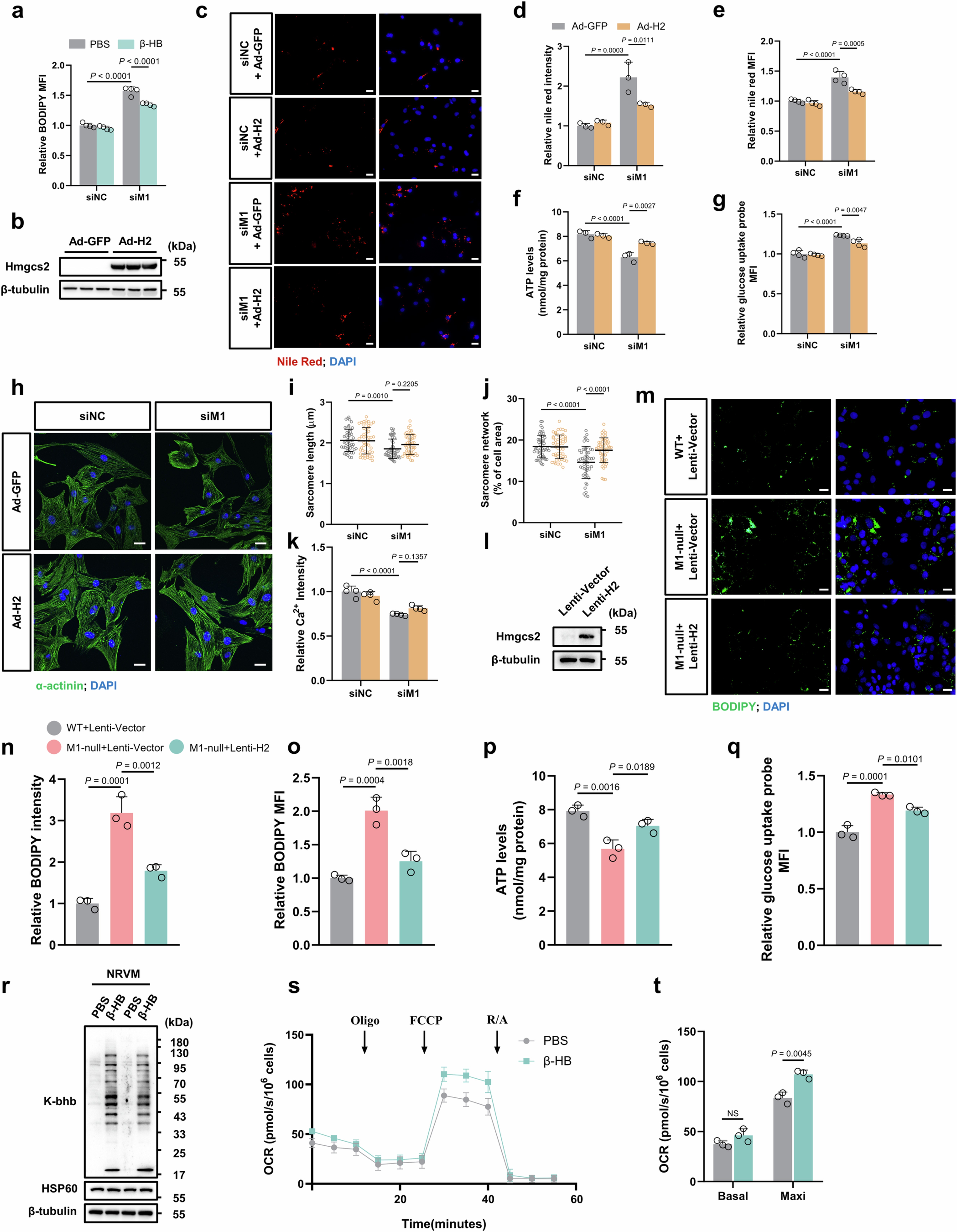 Extended Data Fig. 8: Hmgcs2 overexpression rescues the impaired fatty acid metabolism and immaturity in CM induced by loss of Mettl1.