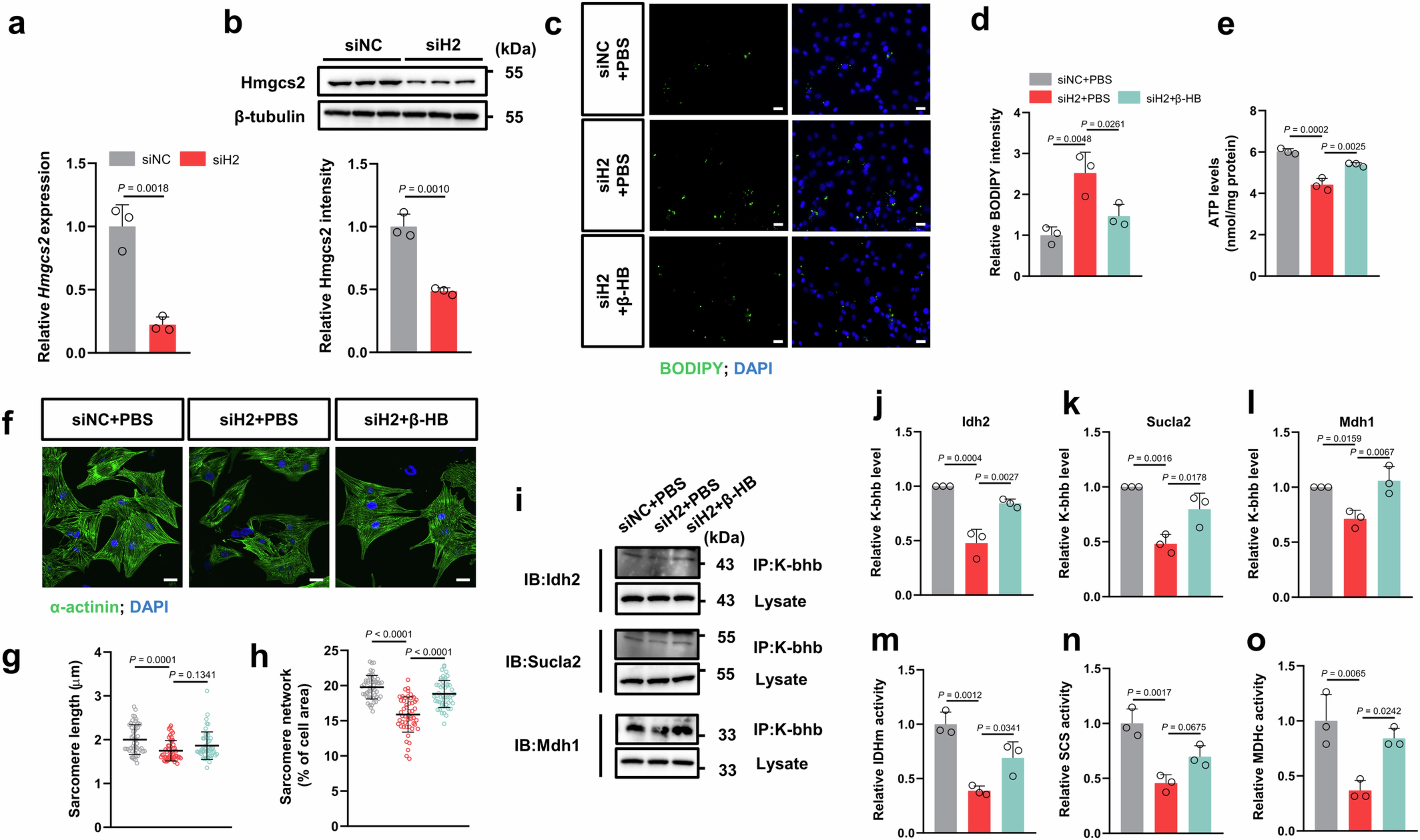 Extended Data Fig. 10: β-HB supplementation rescues the impaired fatty acid metabolism and immaturity in Hmgcs2-KD NRVMs.
