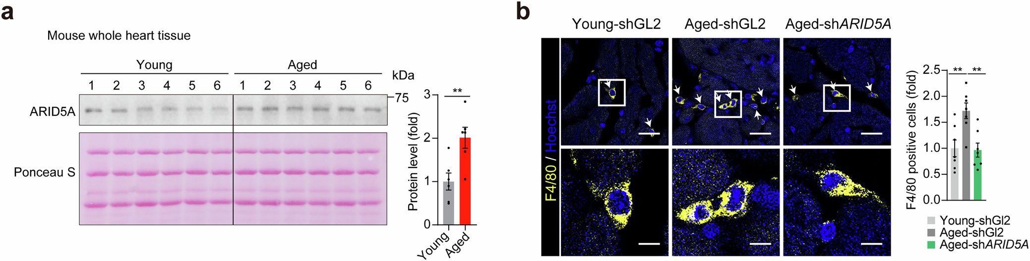 Extended Data Fig. 10: Silencing the expression of ARID5A attenuates cardiac inflammation.