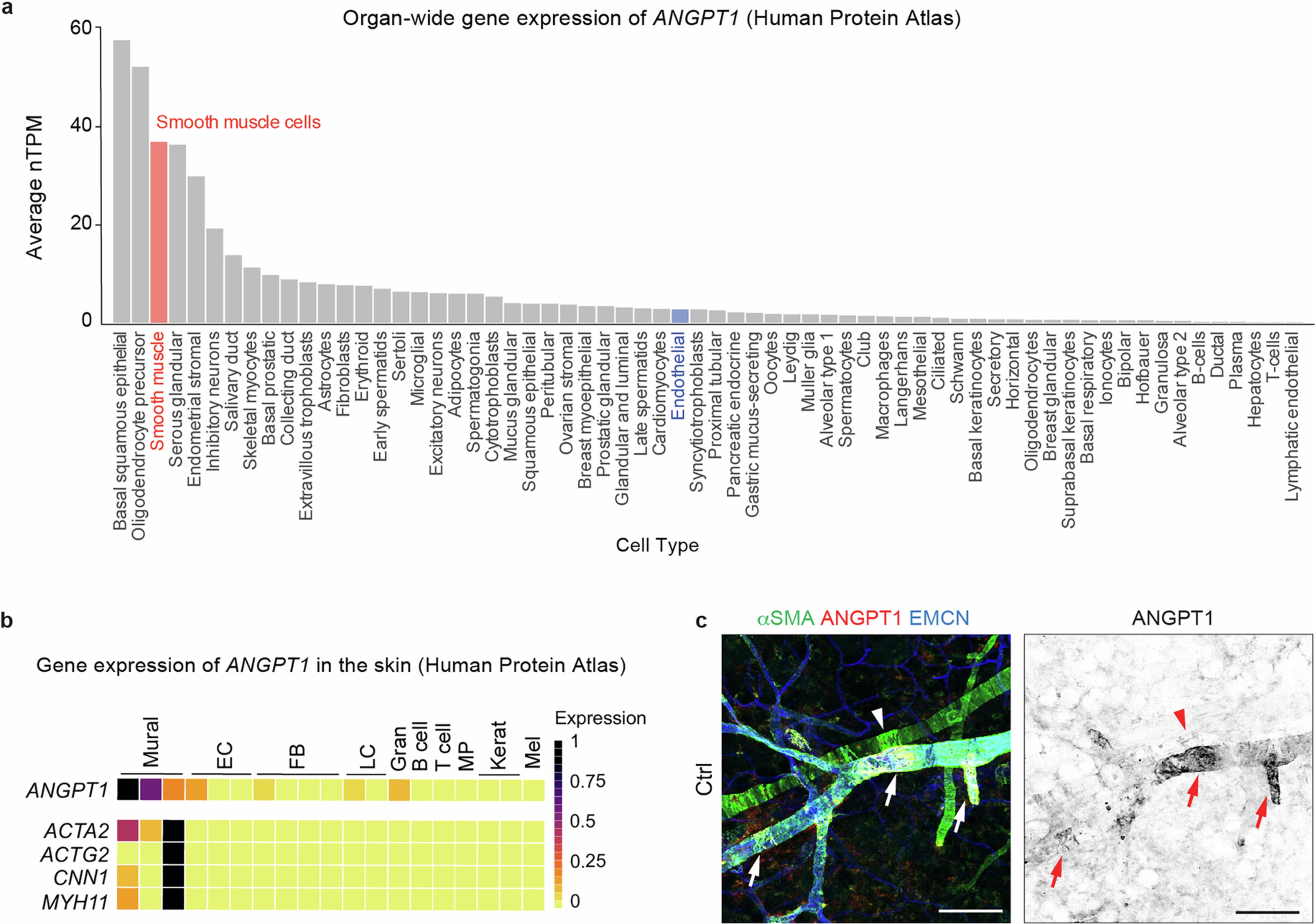 Extended Data Fig. 6: ANGPT1 expression in human and mouse tissues.