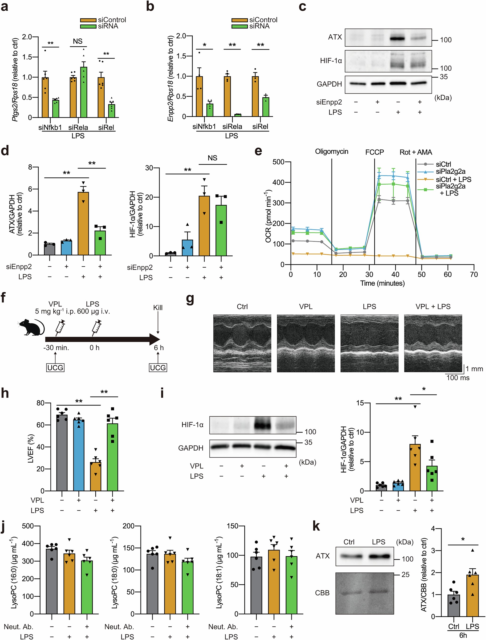 Extended Data Fig. 8: Roles of secretory phospholipase A2 (sPLA2) and lysophosphatidylcholine (lysoPC) in septic cardiomyopathy.