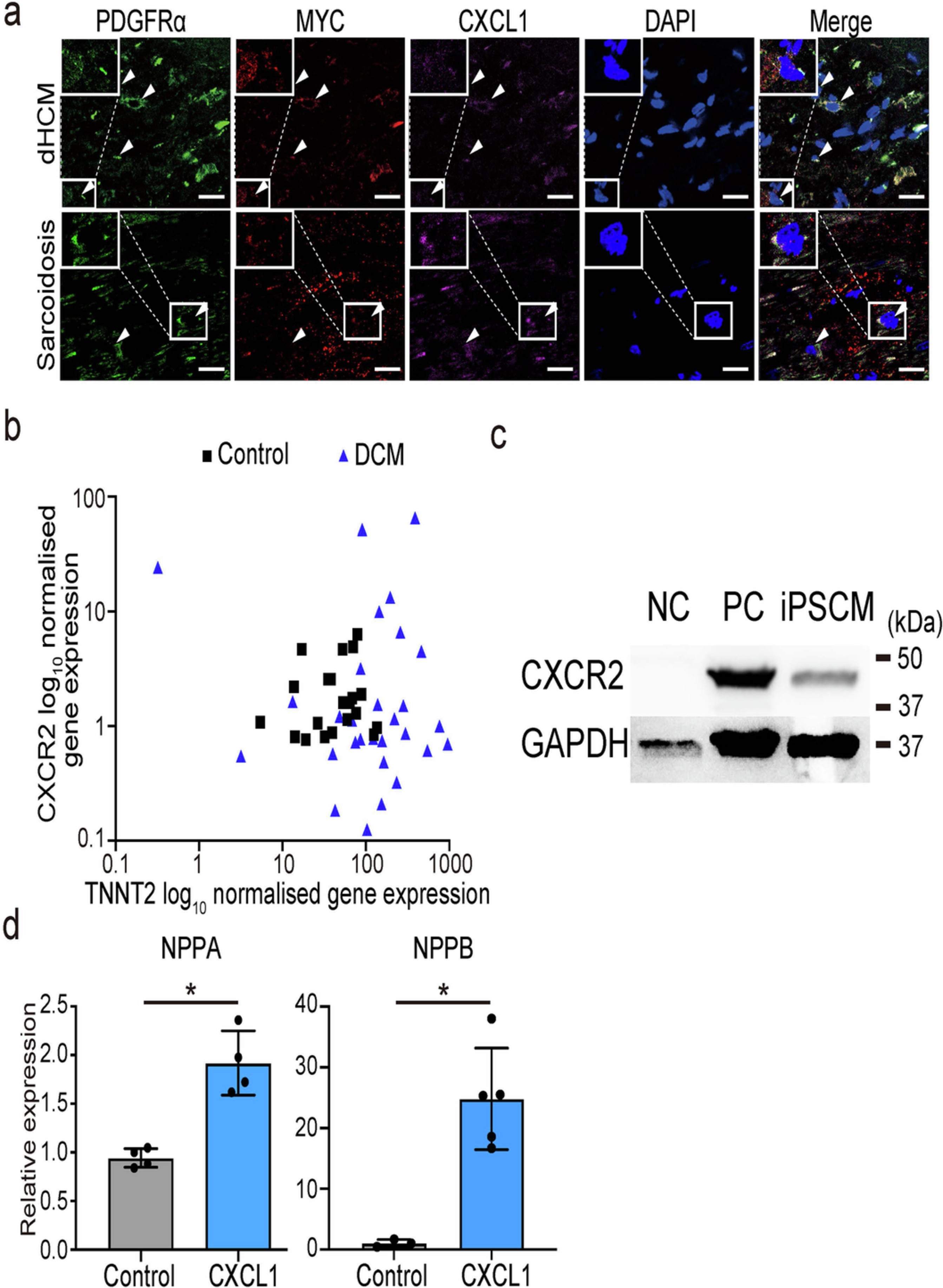 Extended Data Fig. 8: Expressions of MYC and CXCL1 in patients with HF and the effect of CXCL1 on human cardiomyocytes.