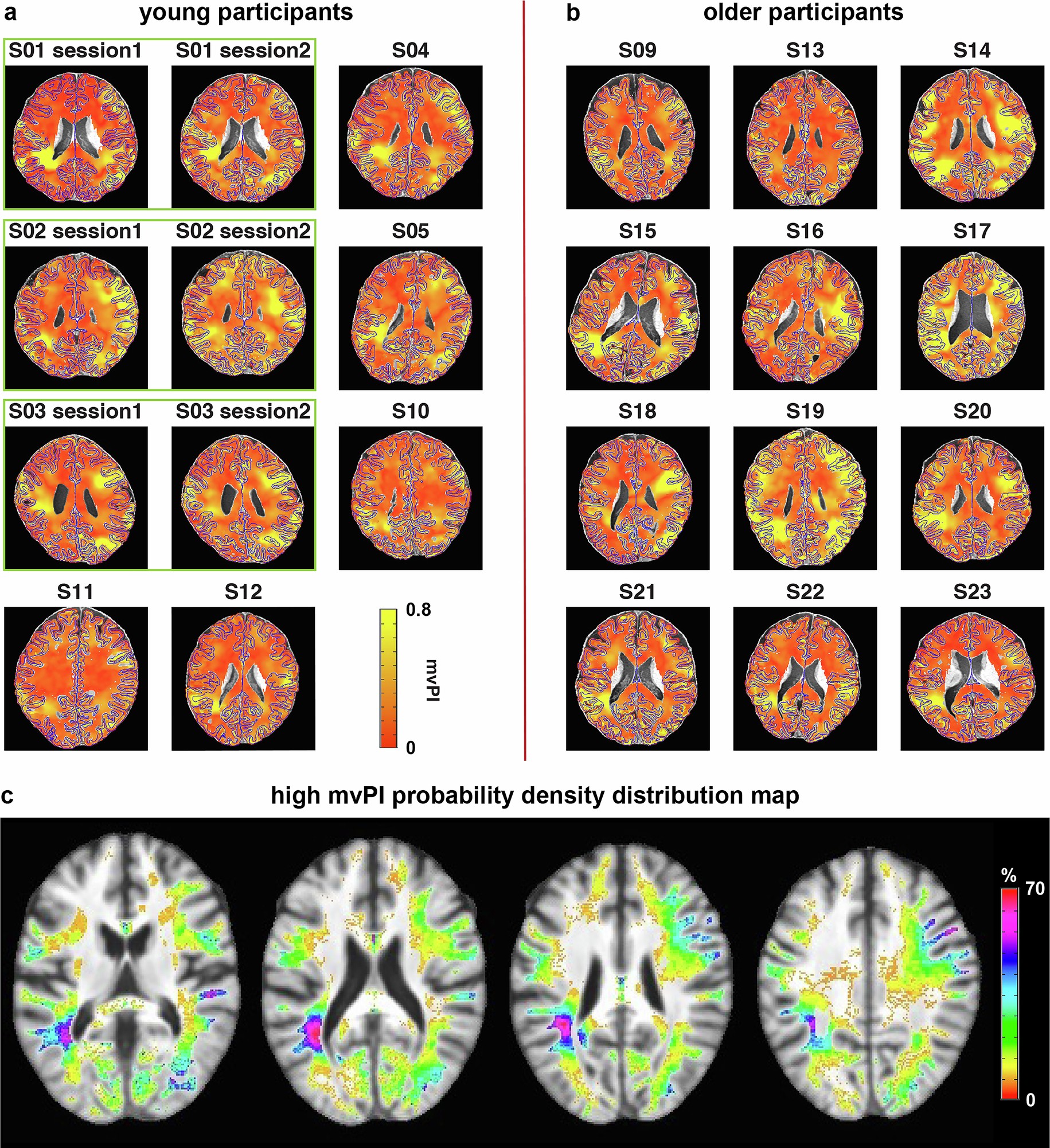 Extended Data Fig. 4
