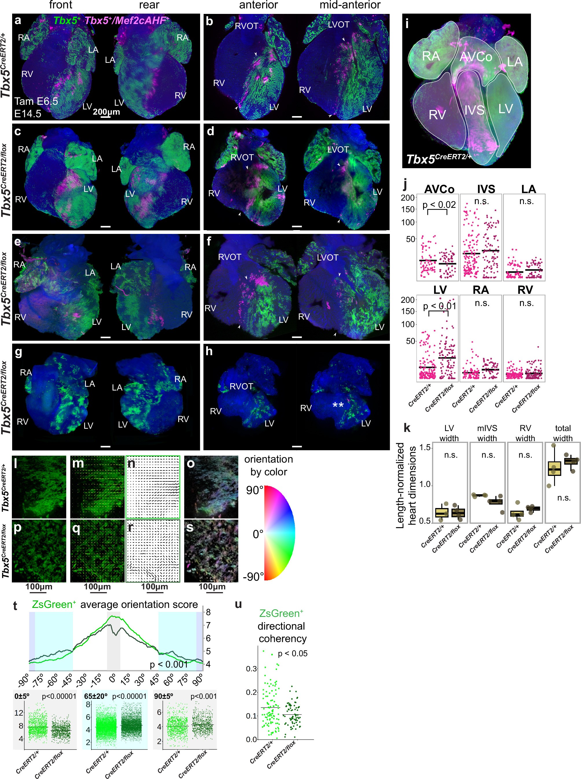 Extended Data Fig. 4: Additional samples of Tbx5 mutant hearts and supplementary quantification of distribution and cell arrangement.