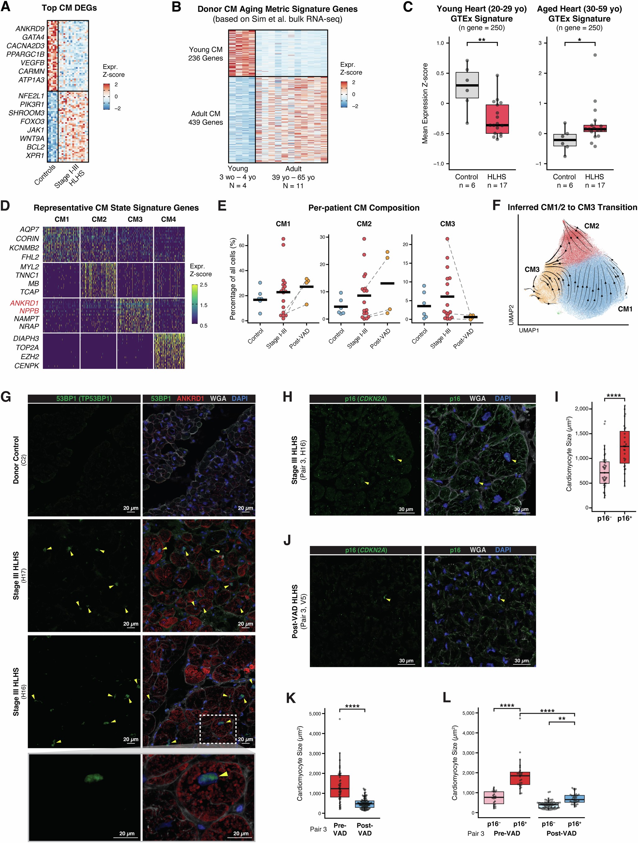 Extended Data Fig. 2: Cardiomyocyte aging signatures, cell states, and immunofluorescence-based characterization.