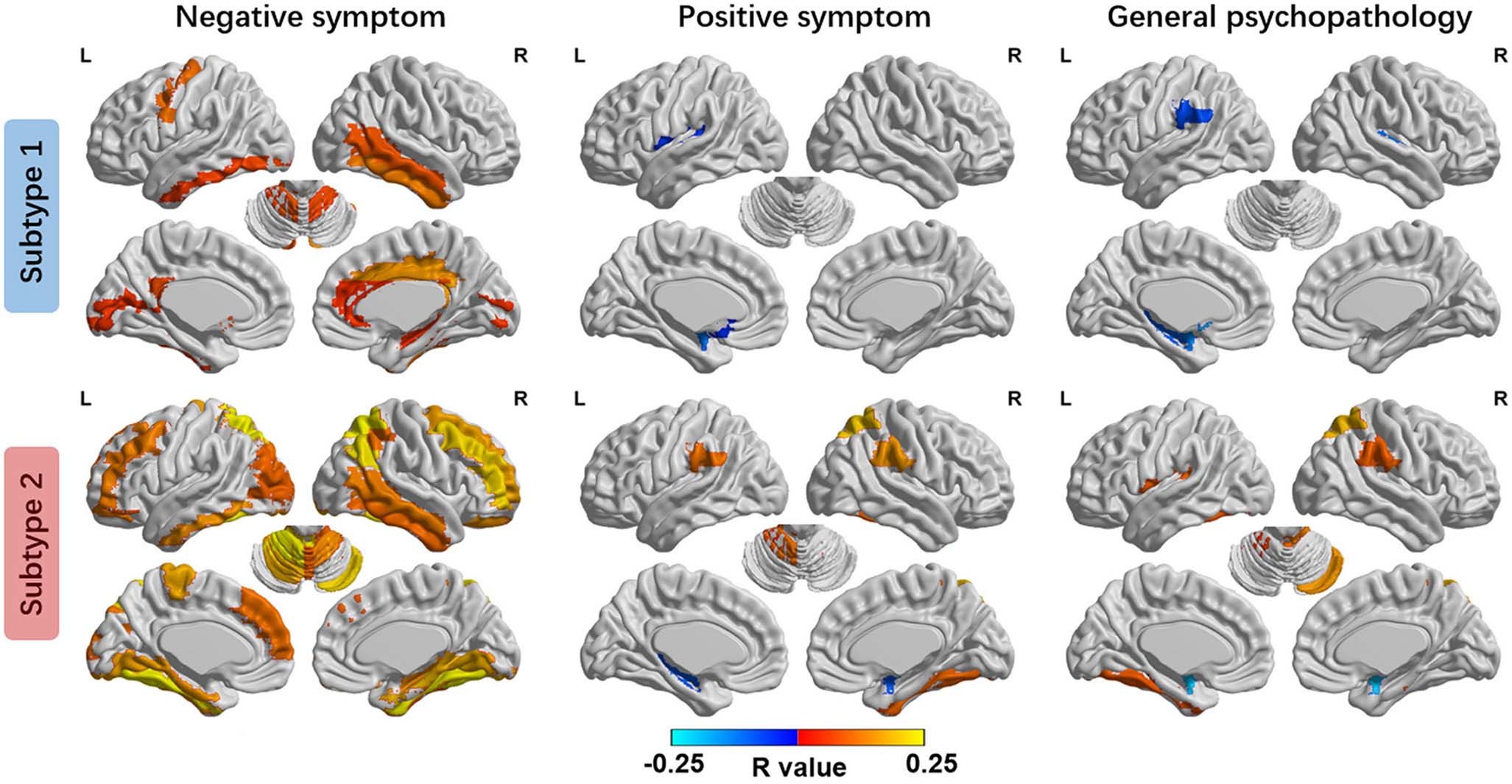 Extended Data Fig. 2: Association between regional atrophy and clinical symptoms.