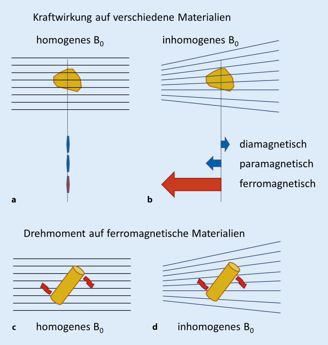 Figure 2 | MRT – Wechselwirkungen mit magnetisch aktivem und elektrisch  leitfähigem Material | SpringerLink