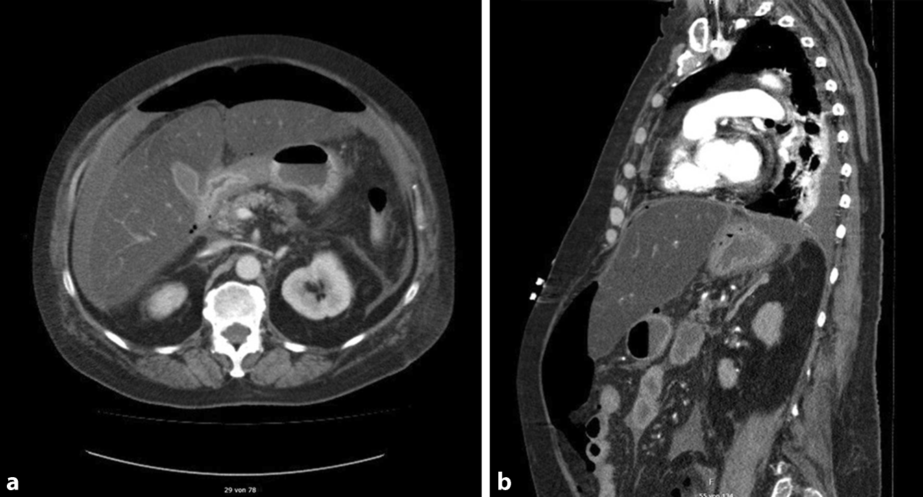 Figure 1 | Akutes Abdomen | SpringerLink