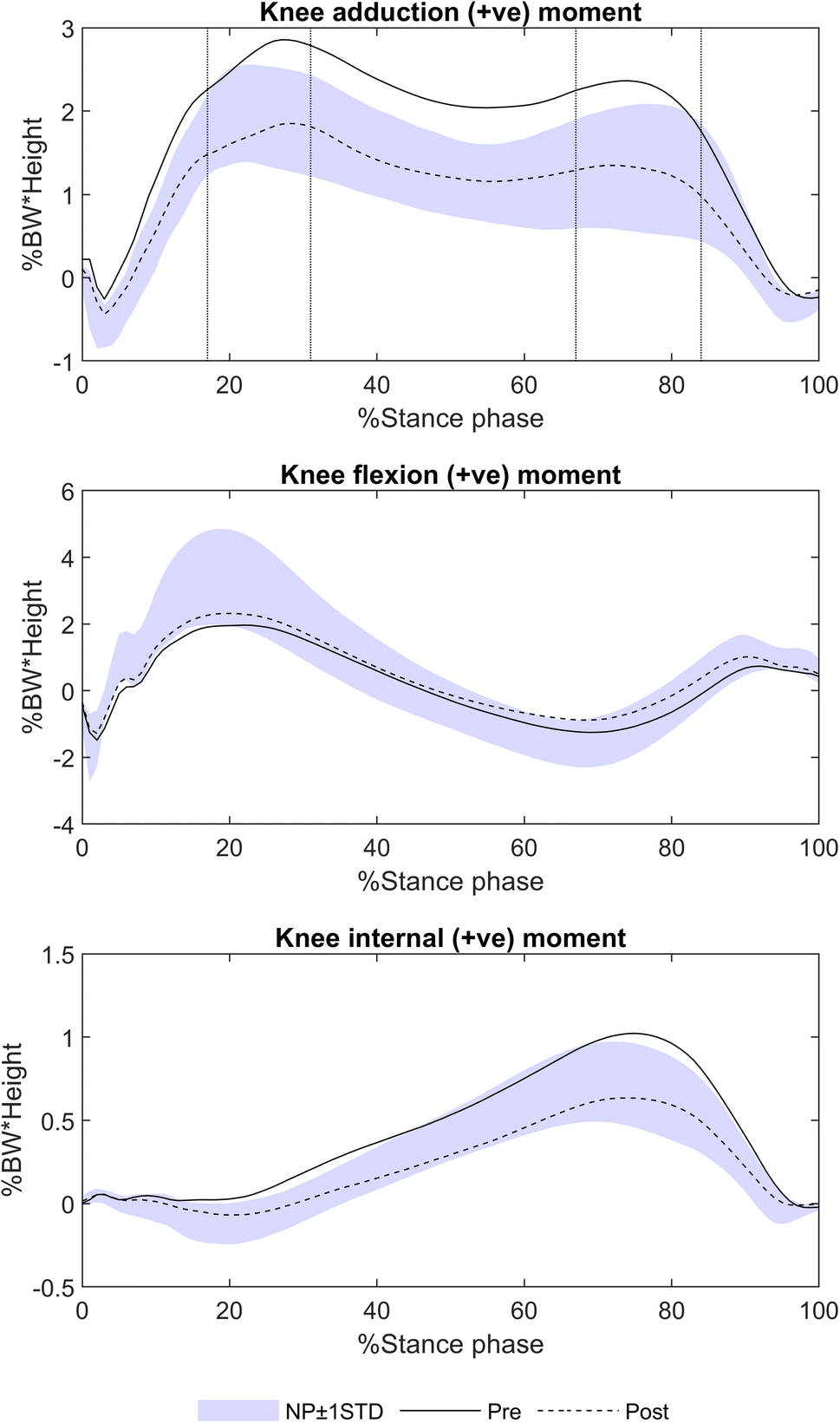 Figure 3 High Tibial Osteotomy Results In Improved Frontal Plane Knee Moments Gait Patterns And Patient Reported Outes Springerlink