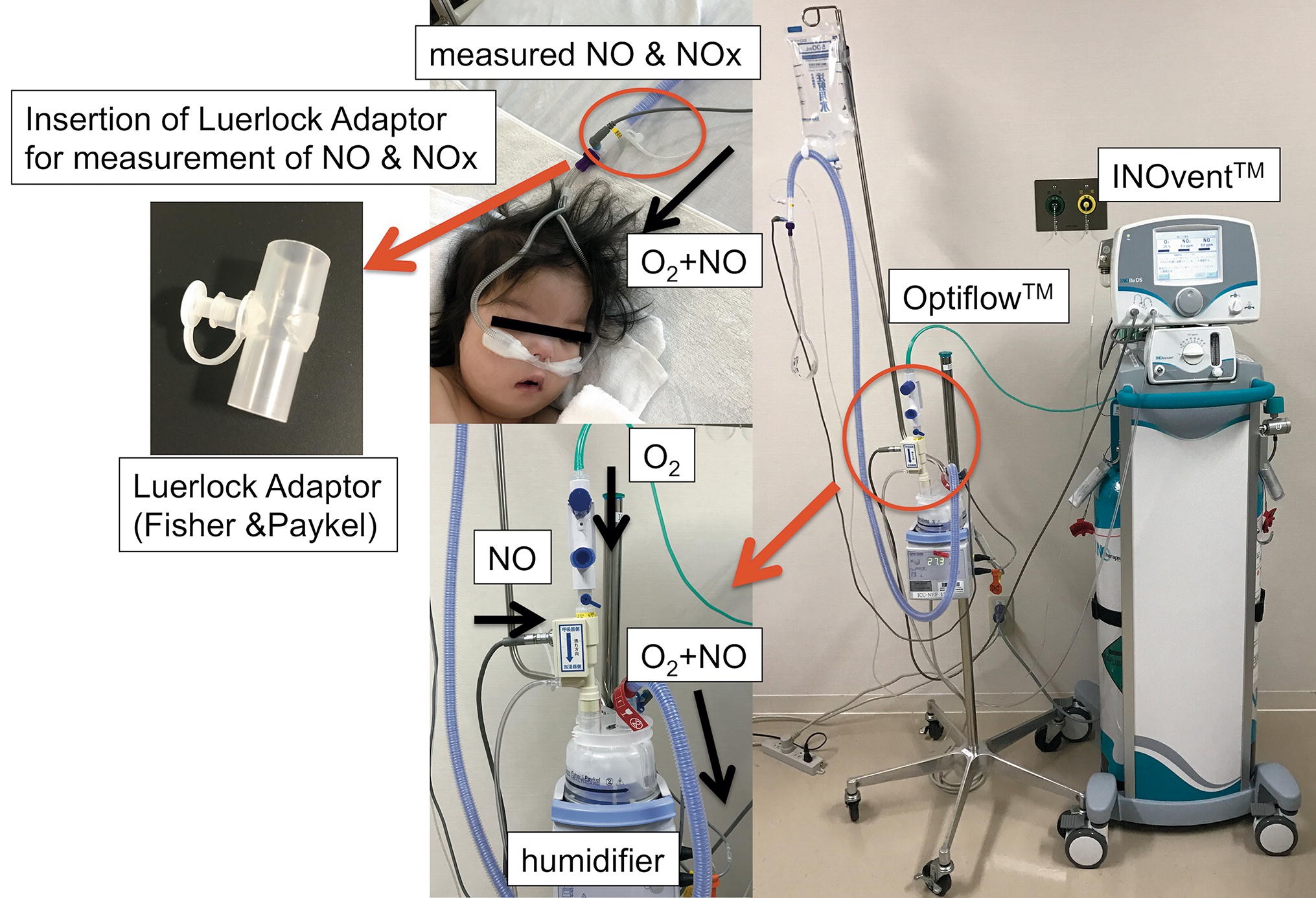 high flow cannula