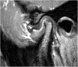 ESPR 2017 | Pediatric Radiology