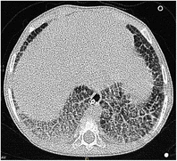 ESPR 2017 | Pediatric Radiology
