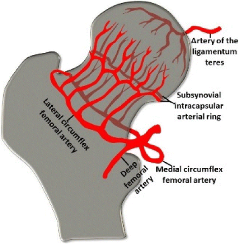 Figure 3 Fragility Fractures Of The Proximal Femur Review And Update For Radiologists Springerlink