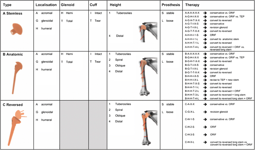 Figure 1 Validation Of A New Classification For Periprosthetic Shoulder Fractures Springerlink