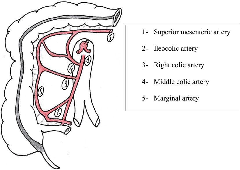 Figure 1 | Arterial vascularization of the right colon with implications for surgery | SpringerLink Figure 1 | Arterial vascularization of the right colon with implications for surgery | SpringerLink