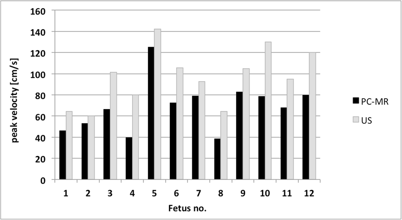 Figure 4 Fetal Dynamic Phase Contrast Mr Angiography Using Ultrasound Gating And Comparison With Doppler Ultrasound Measurements Springerlink