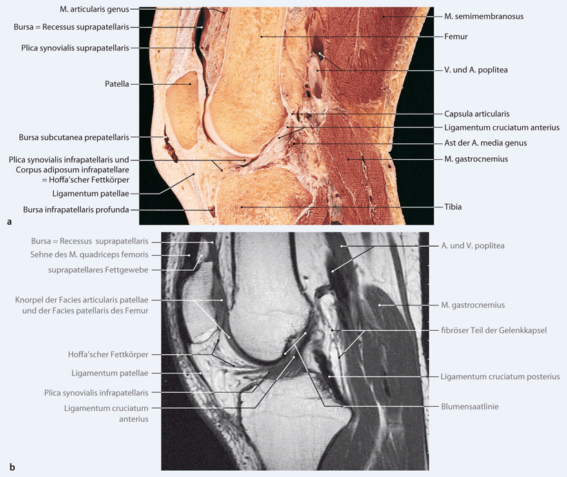 Anatomia articulației genunchiului. sac de genunchi