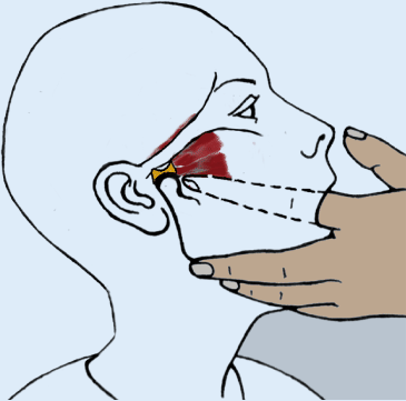 Figure 1 Digitale Palpation Des M Pterygoideus Lateralis Springerlink