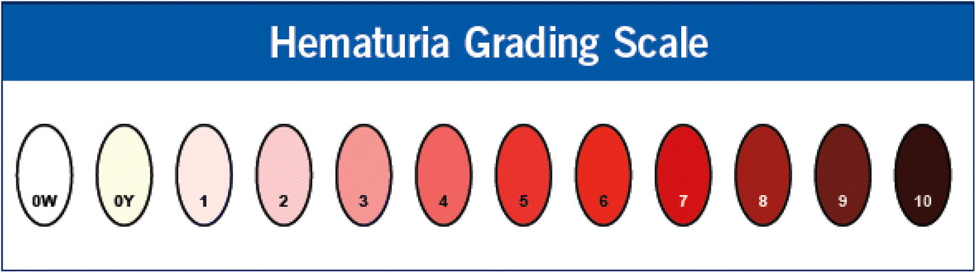 hematuria a prostatitis alatt