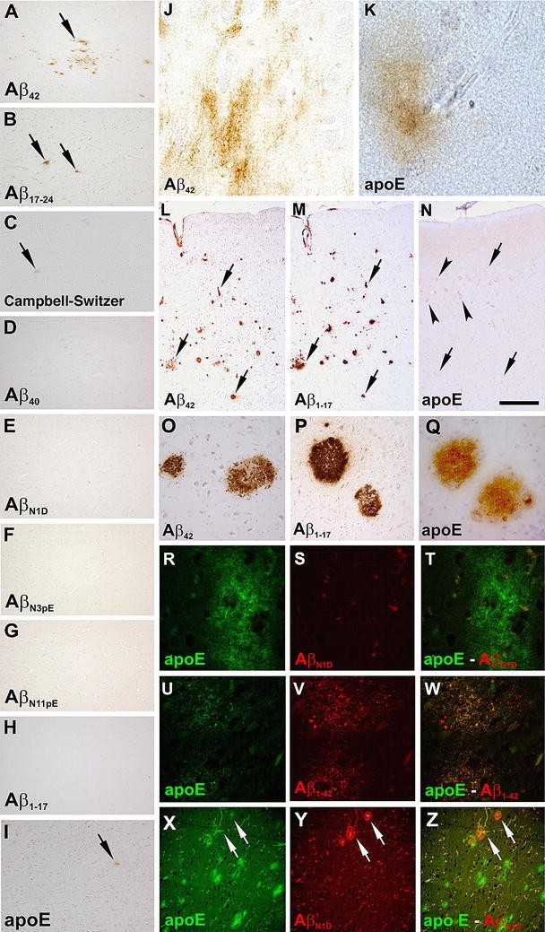 Figure 1 Apolipoprotein E Co Localizes With Newly Formed Amyloid B Protein Ab Deposits Lacking Immunoreactivity Against N Terminal Epitopes Of Ab In A Genotype Dependent Manner Springerlink