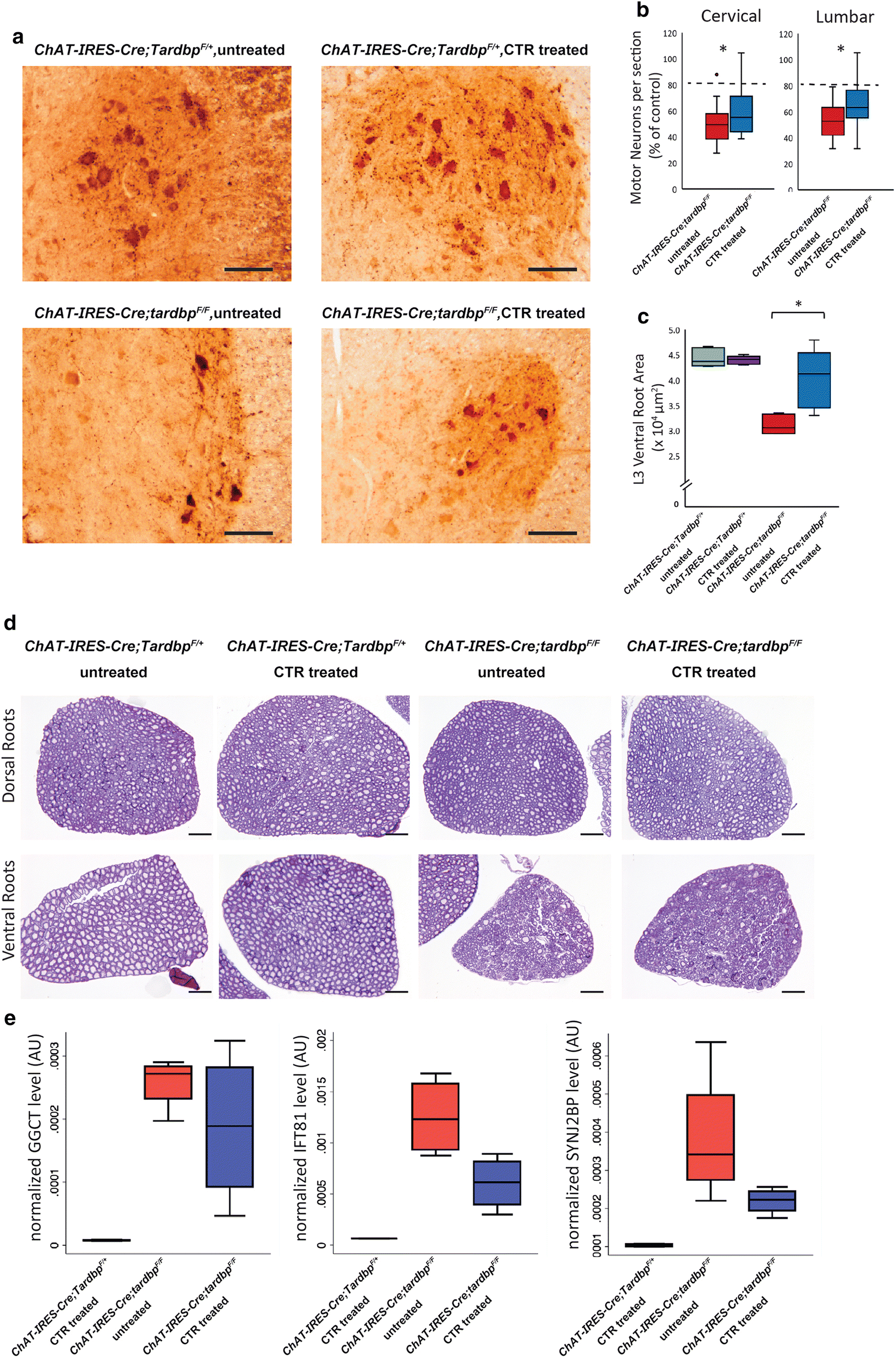 Figure 5 Splicing Repression Is A Major Function Of Tdp 43 In Motor Neurons Springerlink Figure 5 Splicing Repression Is A Major Function Of Tdp 43 In Motor Neurons Springerlink