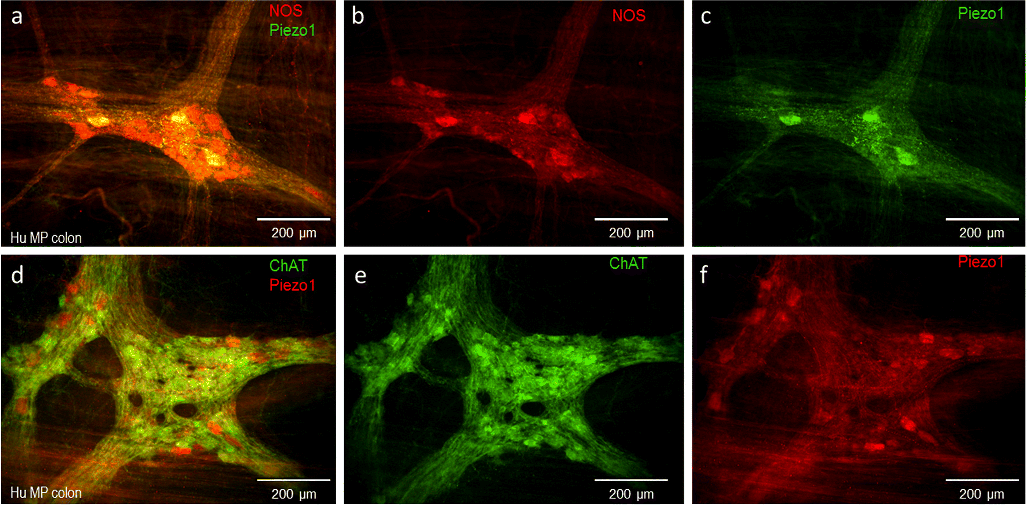 Figure 9 Piezo Proteins Incidence And Abundance In The Enteric Nervous System Is There A Link With Mechanosensitivity Springerlink Figure 9 Piezo Proteins Incidence And Abundance In The Enteric Nervous System Is There A Link With Mechanosensitivity Springerlink