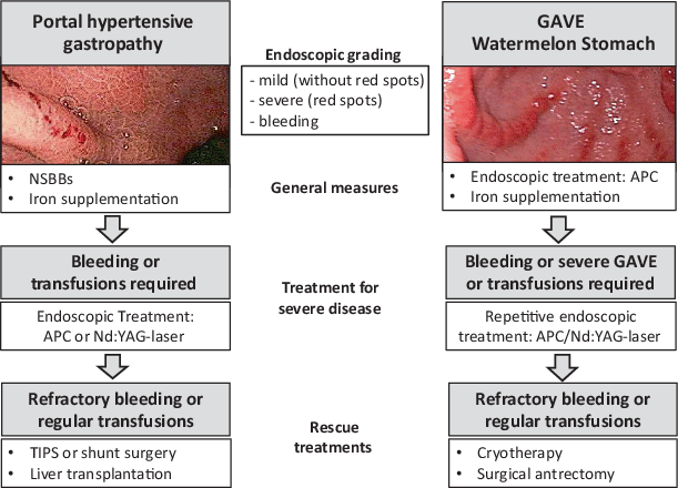 Figure 3 Austrian Consensus Guidelines On The Management And Treatment Of Portal Hypertension Billroth Iii Springerlink