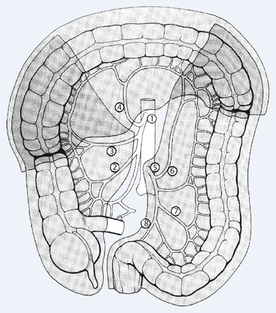 Figure 4 Chirurgie Des Kolonkarzinoms Springerlink