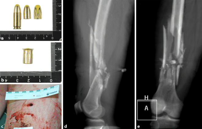 Figure 3 Schussbruch Springerlink