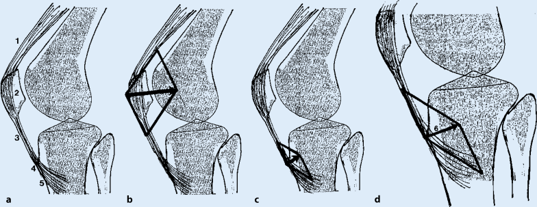 Figure 5 Apophysenschaden Funktionelle Anatomie Und Deren Bedeutung Fur Die Begutachtung Springerlink