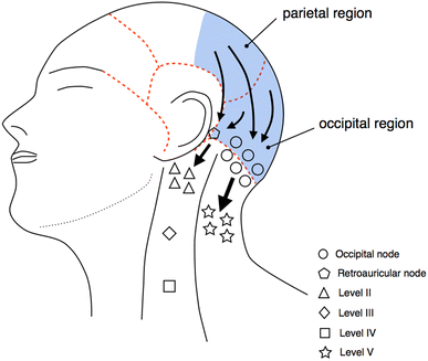 Figure 2 Dominant Lymph Drainage Patterns In The Occipital And Parietal Regions Evaluation Of Lymph Nodes In Patients With Skin Cancer Of The Head Springerlink